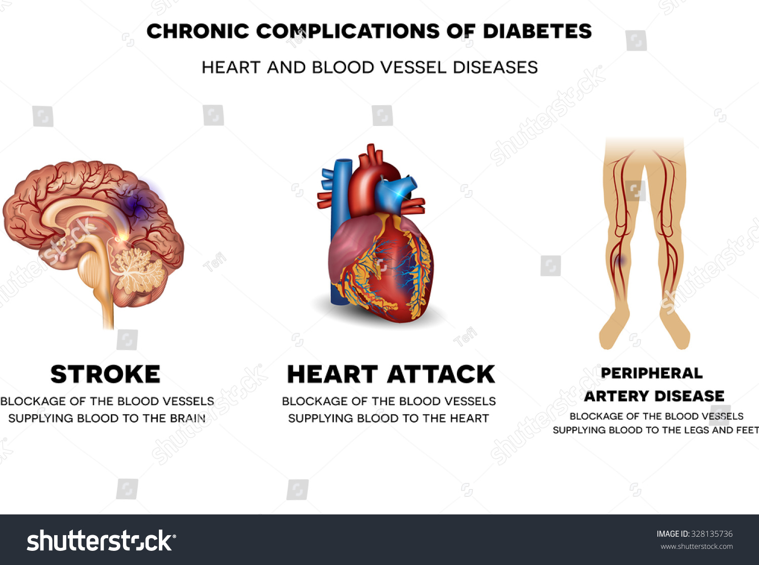 an analysis of diabetes in chronic diseases An overview of chronic disease models: comprising mainly cardiovascular diseases, diabetes, chronic lung the stratification analysis was performed by chronic. an analysis of diabetes in chronic diseases An overview of chronic disease models: comprising mainly cardiovascular diseases, diabetes, chronic lung the stratification analysis was performed by chronic.