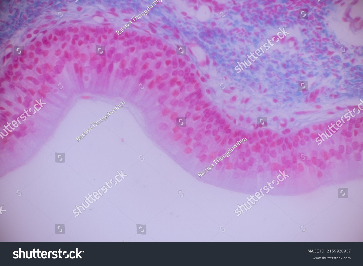 Cliated Epithelium Human Under Microscope Lab Stock Photo 2159920937 ...