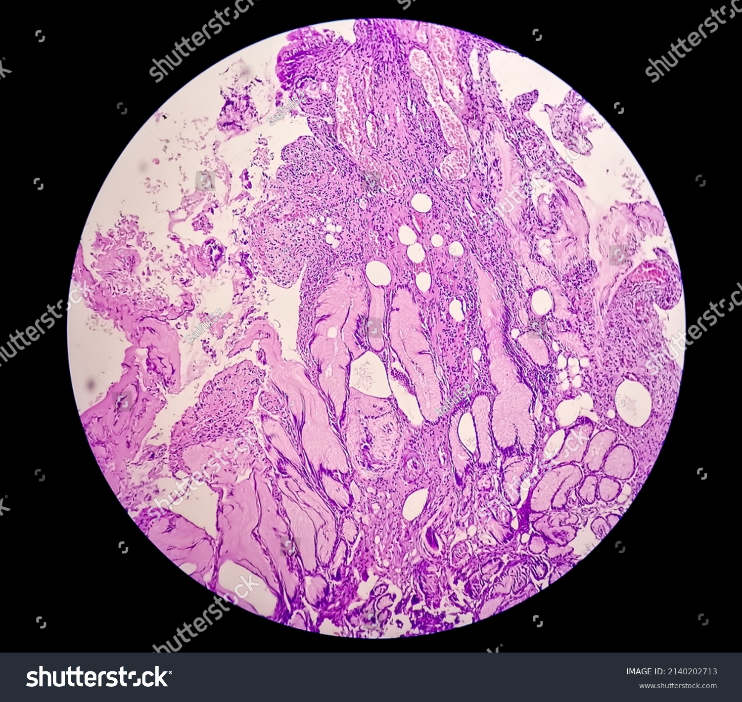 Close Microscopic View Stomach Tissue Biopsy Stock Photo 2140202713 ...