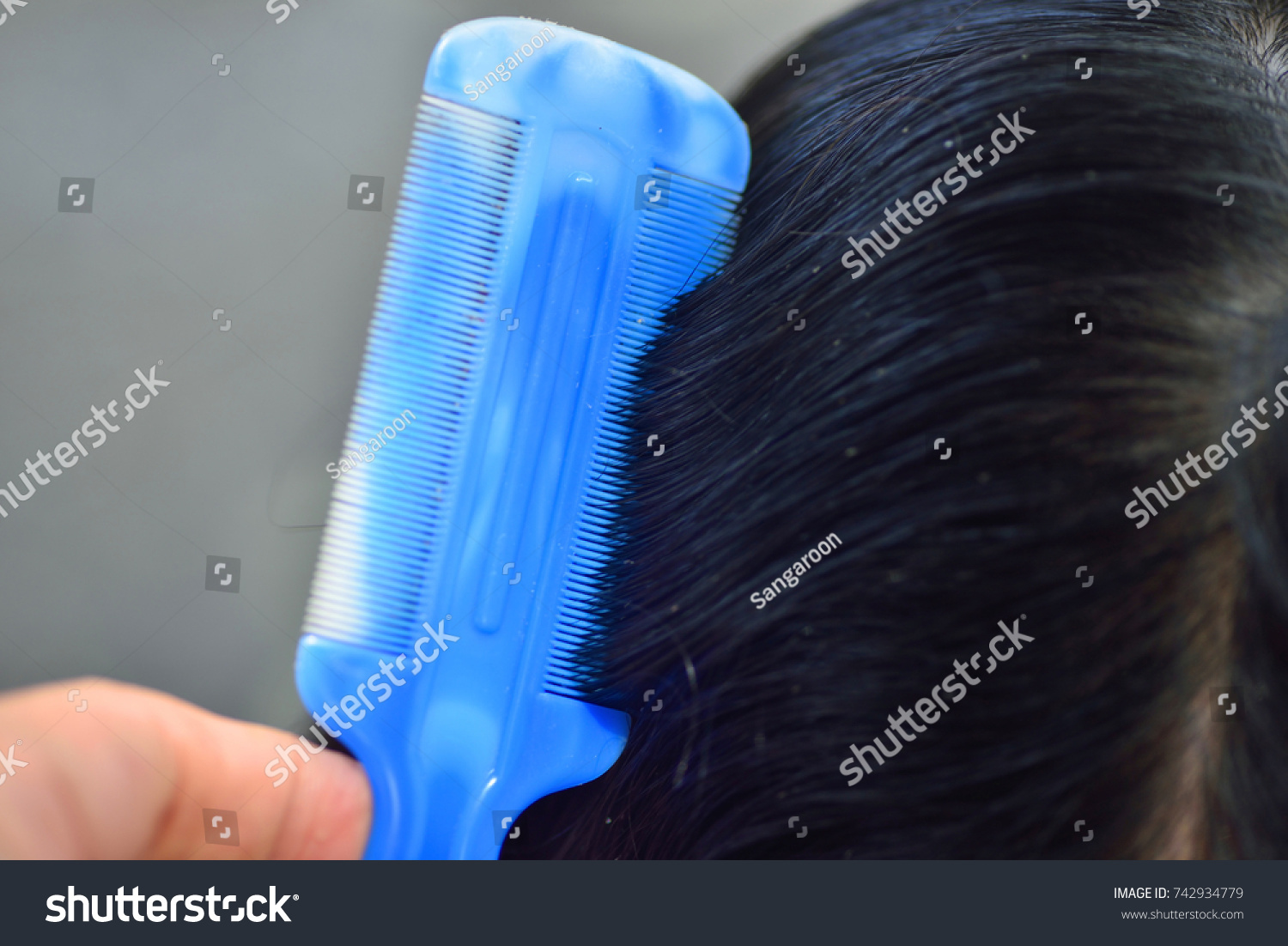 Close Black Hair Lice Eggs Head Stock Photo 742934779 Shutterstock