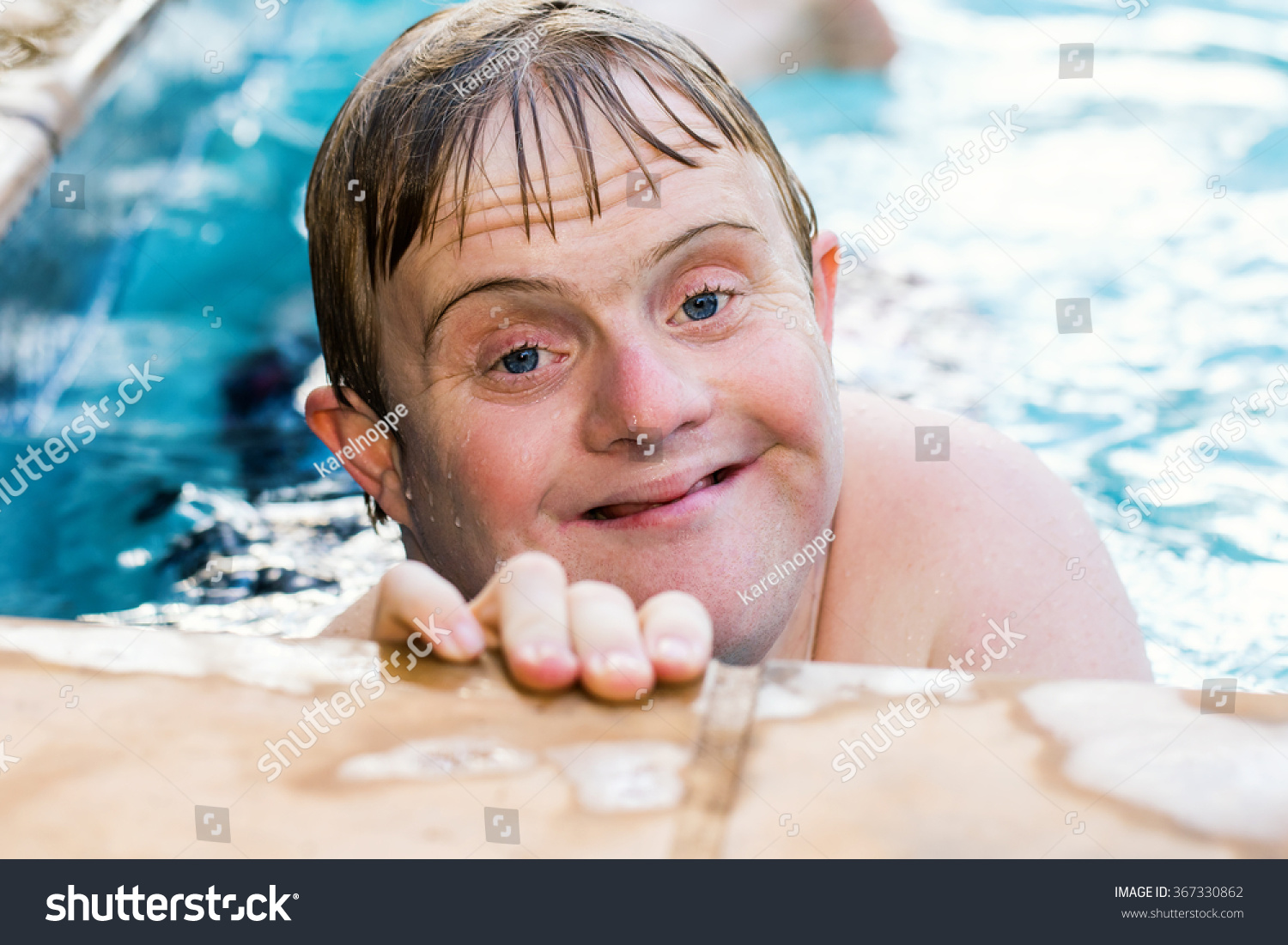 299 Down Syndrome Pool Images Stock Photos And Vectors Shutterstock