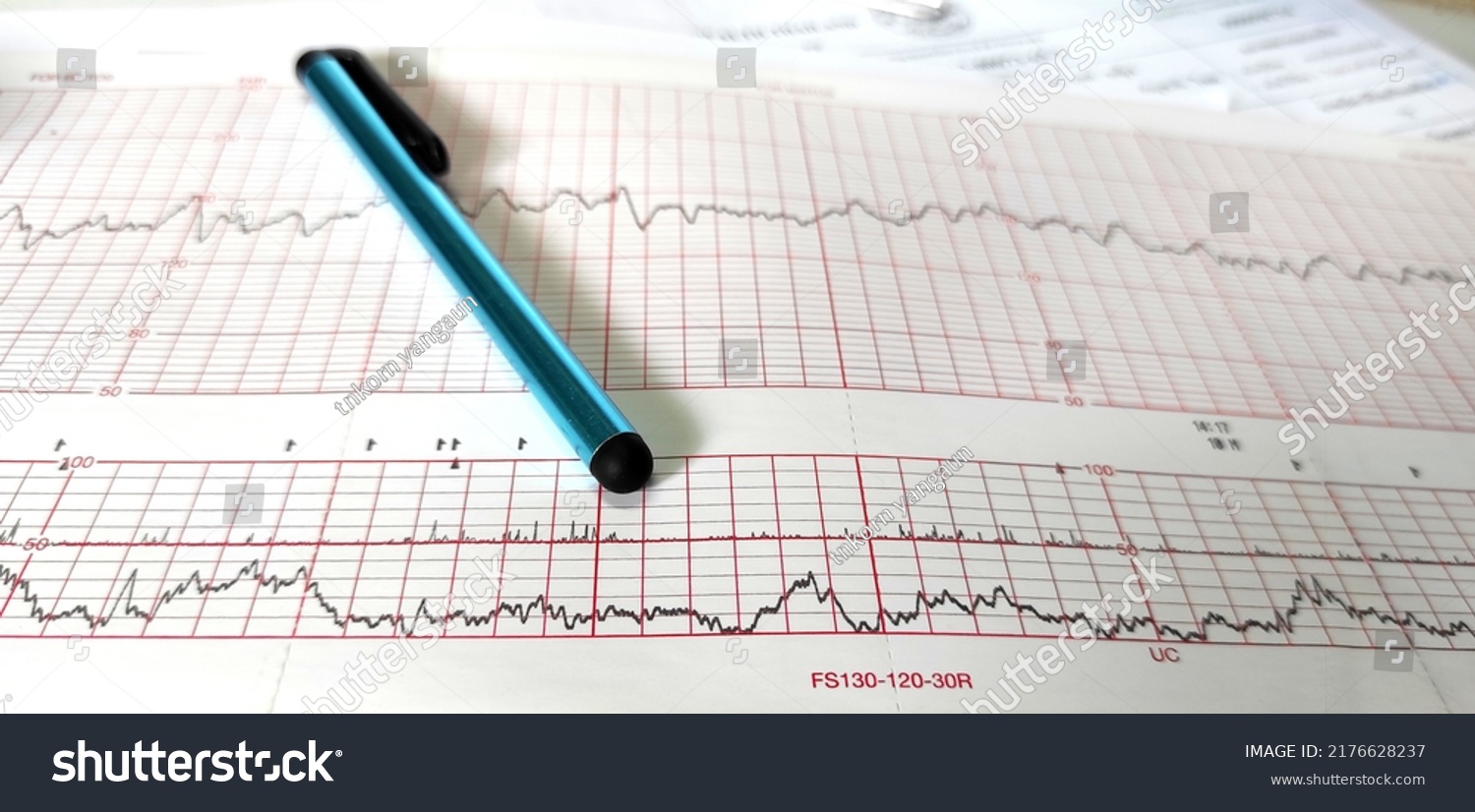 Close Nst Paper Medical Method Monitoring Stock Photo 2176628237 ...