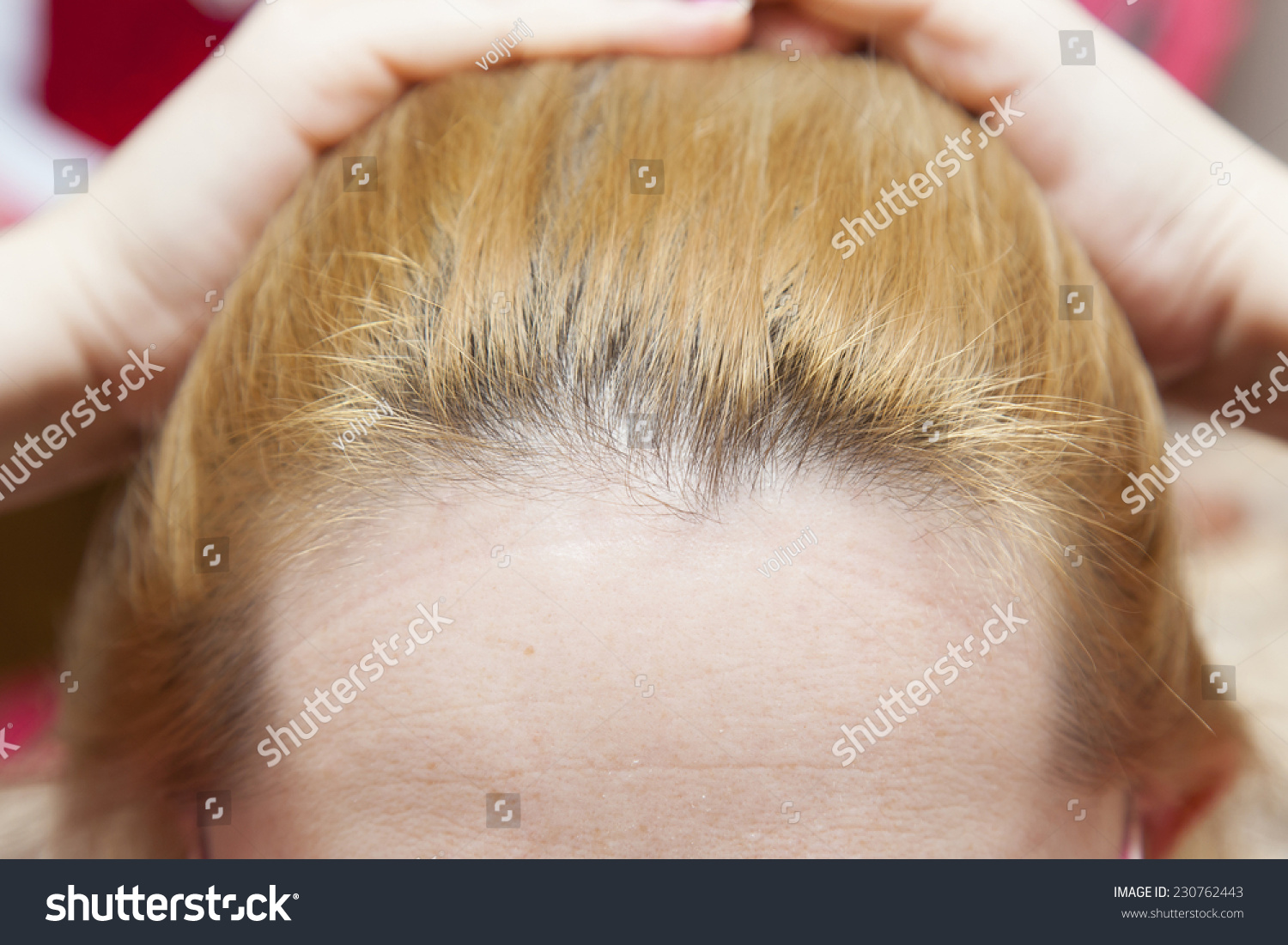 Close Humans Head Thick Hair Stock Photo Edit Now 230762443