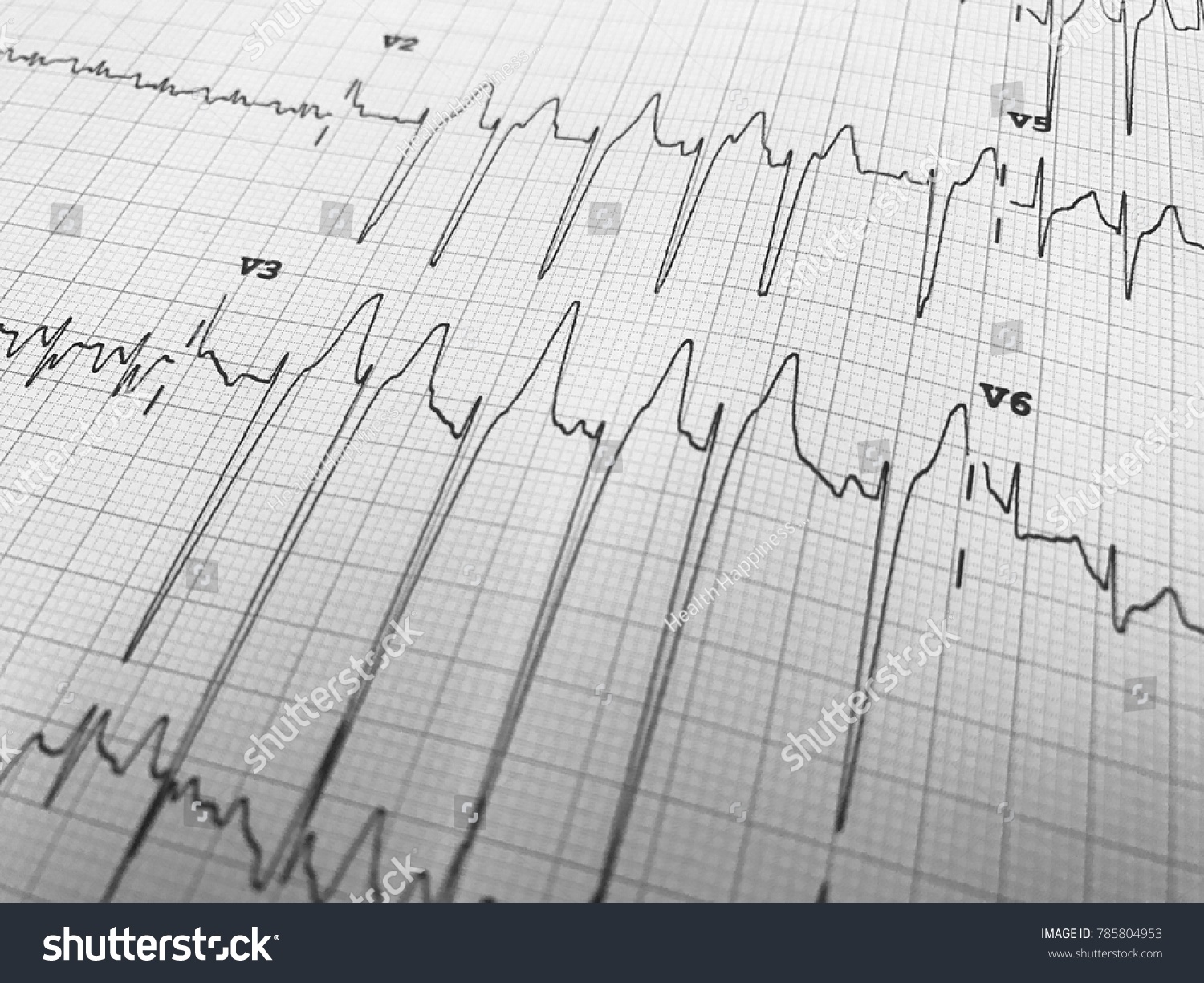 Close Electrocardiogram Paper Form Ecg Ekg Stock Photo 785804953 ...