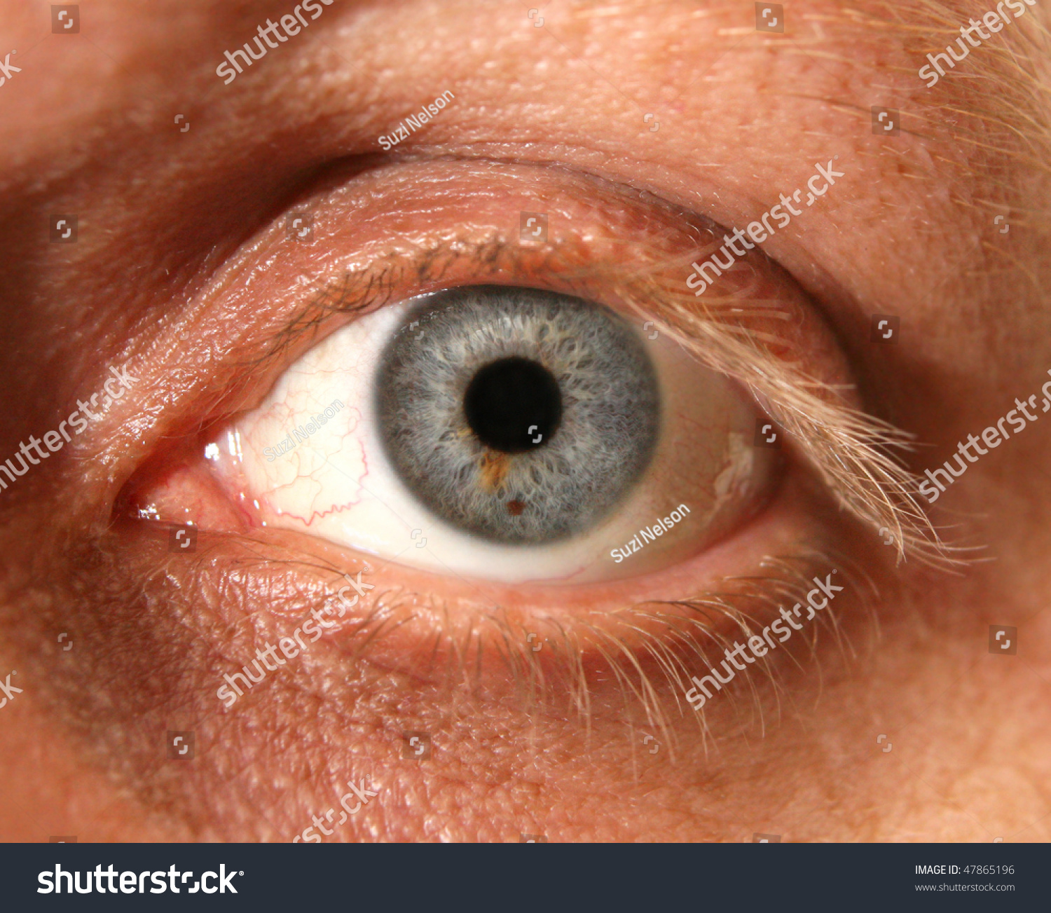 Close Eye Birthmark Stock Photo 47865196 - Shutterstock