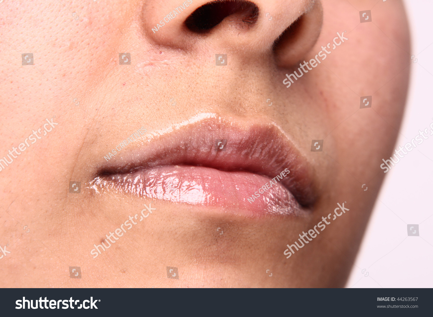 Close-Up Of The Face With A Bad Skin Stock Photo 44263567 : Shutterstock