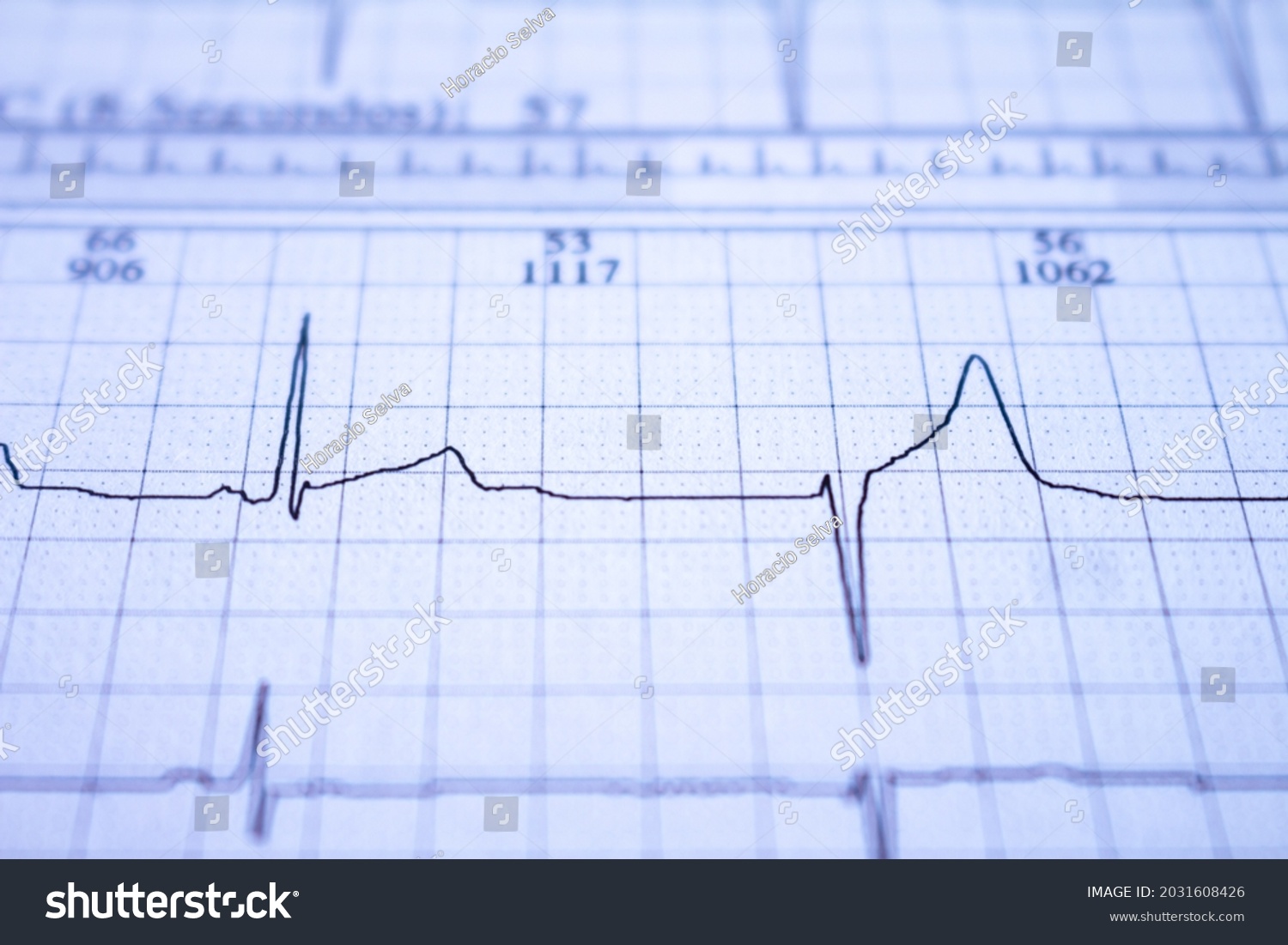 901 Abnormal ecg Images, Stock Photos & Vectors | Shutterstock