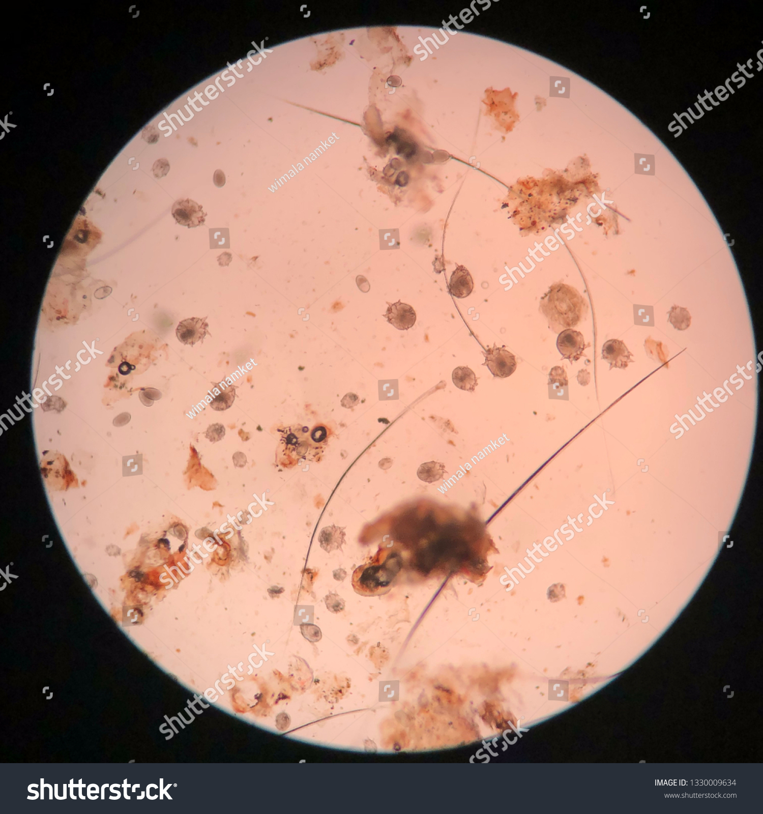 Closed Sarcoptic Mange Microscope Stock Photo 1330009634 | Shutterstock