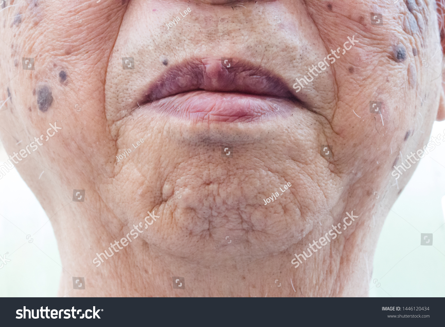 Closeup Age Spots Skin Liver Spots Stock Photo Edit Now