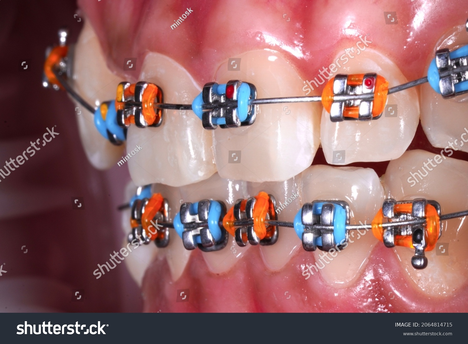 12,473 Ring teeth Images, Stock Photos & Vectors | Shutterstock