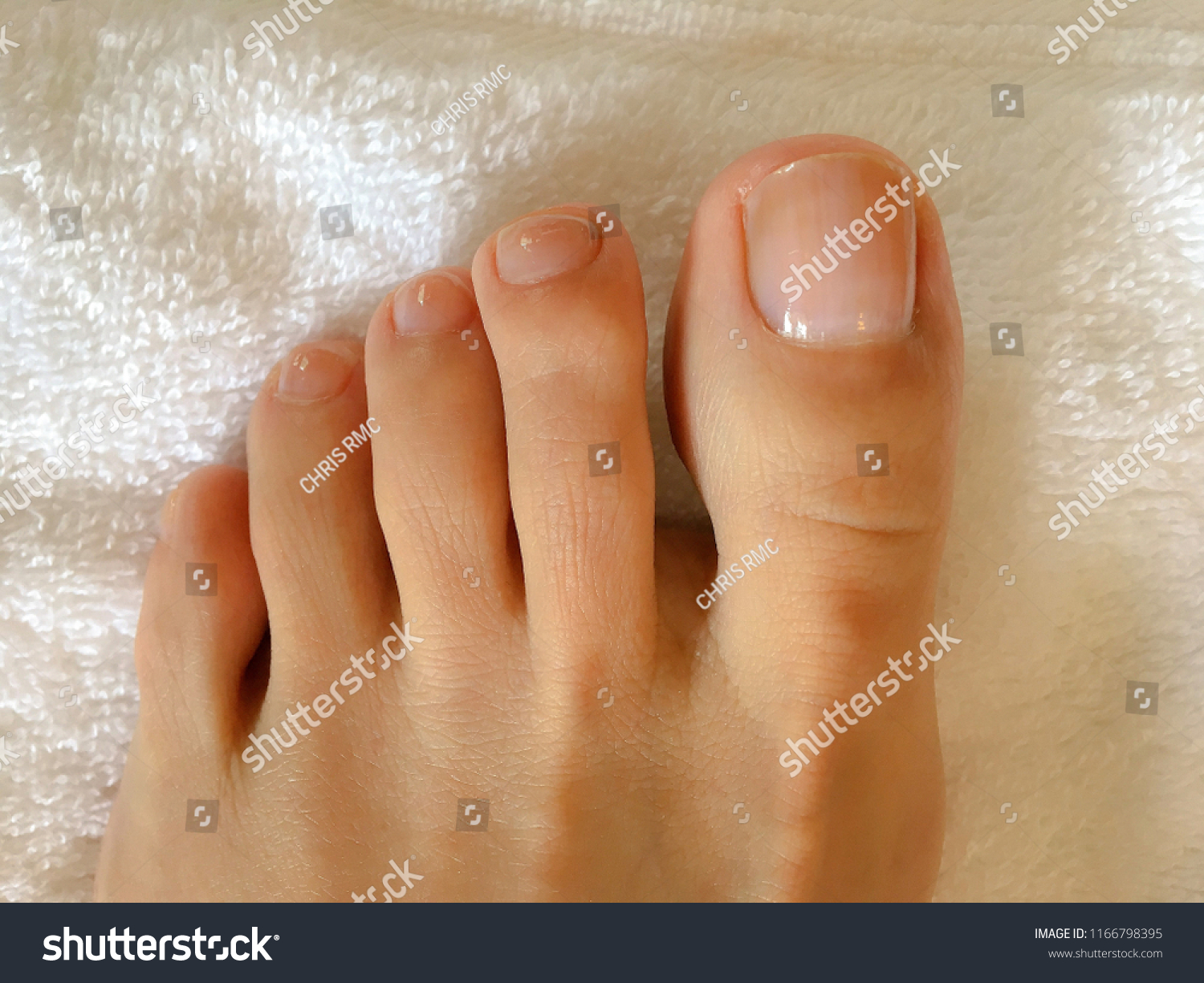 Toes soles and Foot Pain:
