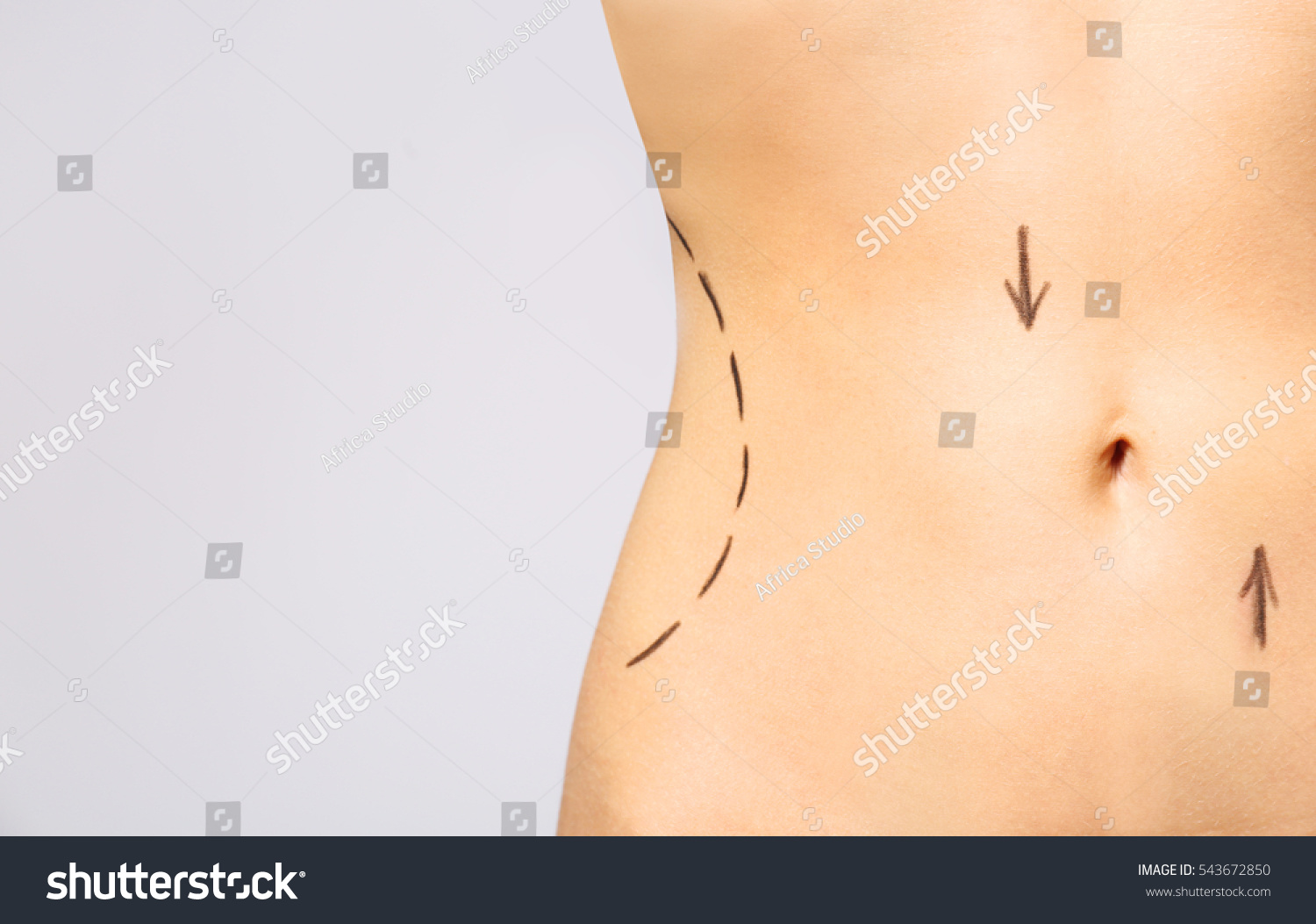 Closeup View Female Belly Marked Plastic Stock Photo 543672850