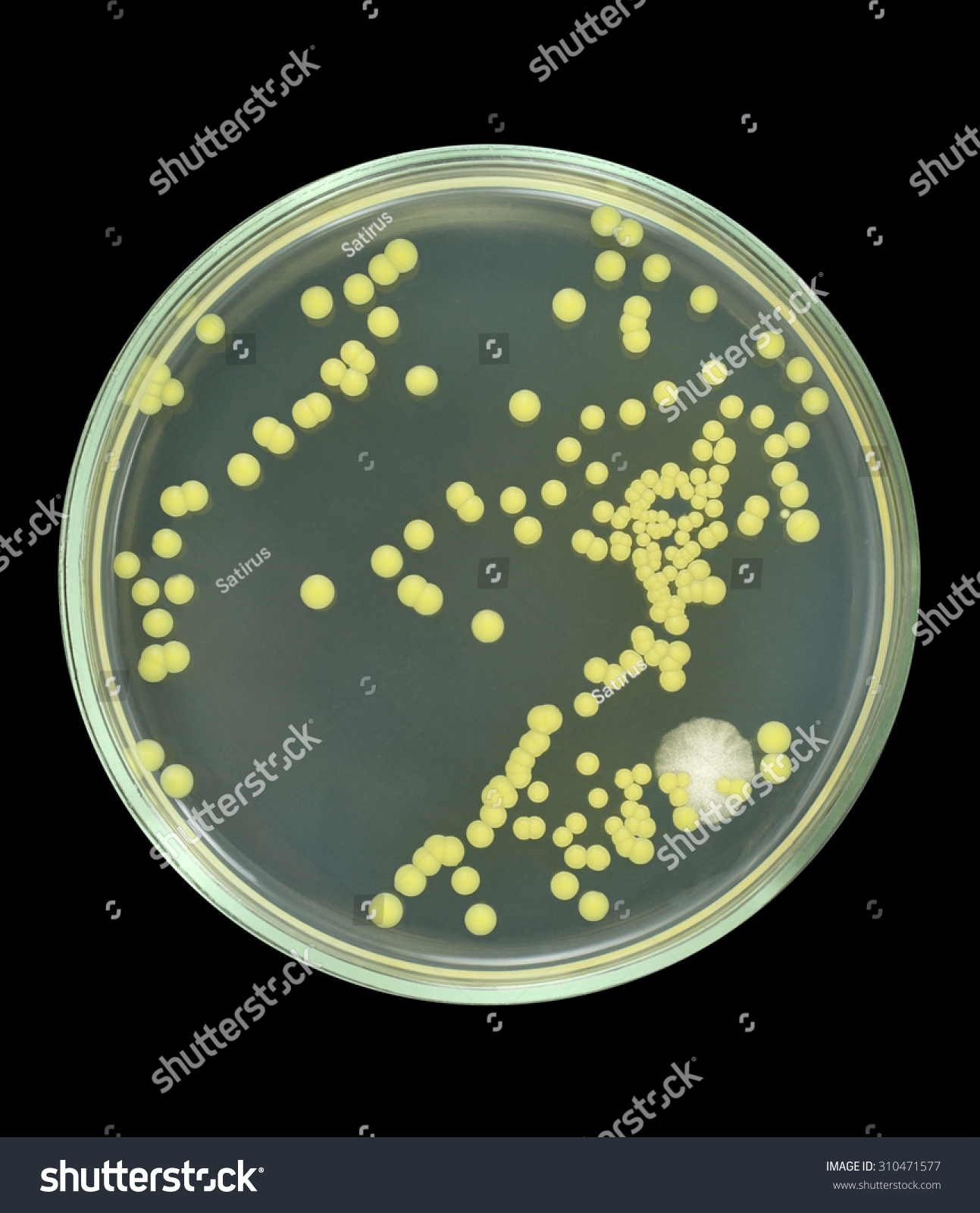 Colonies Bacteria Sea Water On Petri Stock Photo 310471577 - Shutterstock