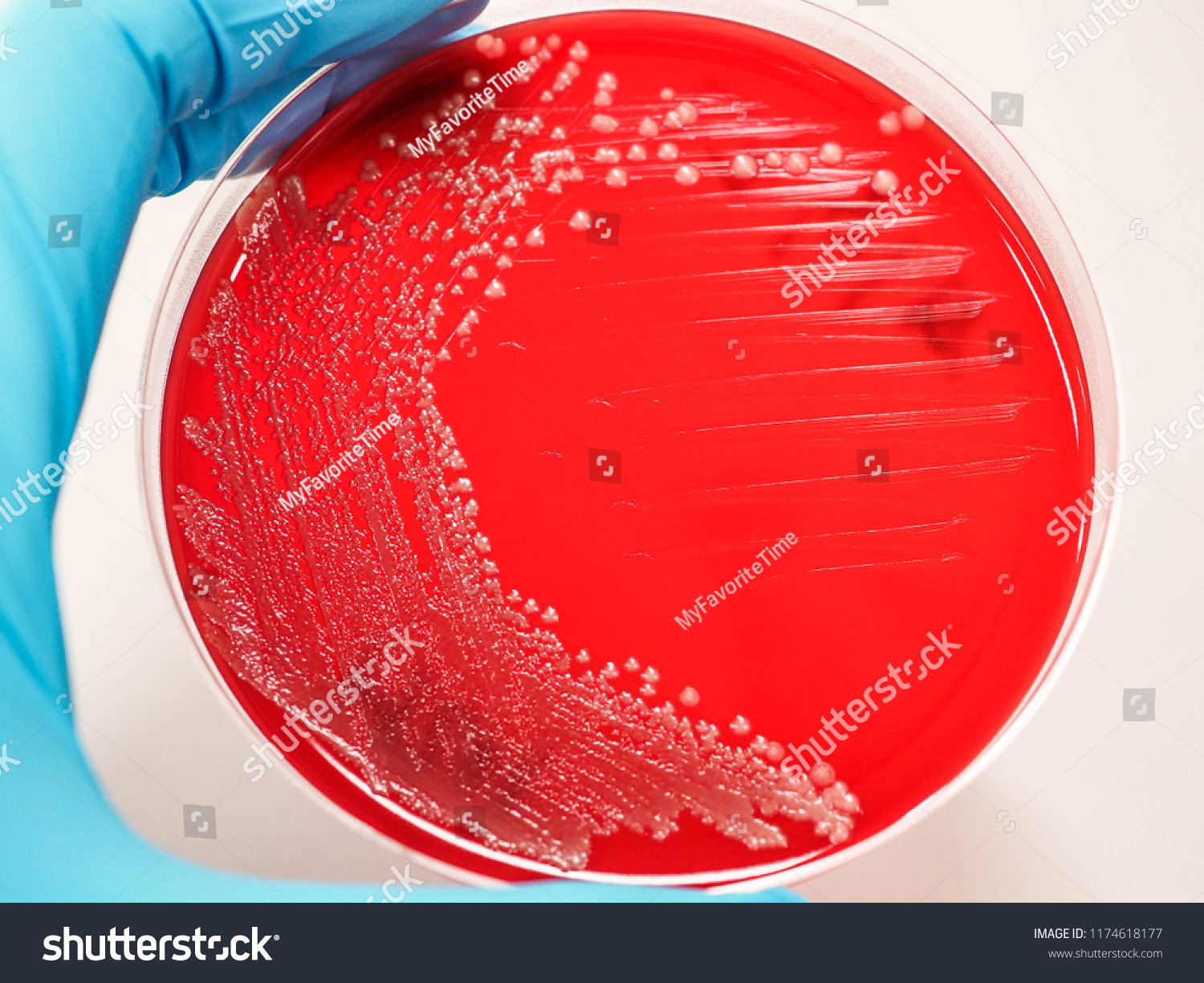 Colonies Cryptococcus Neoformans On Blood Agar Stock Photo 1174618177 ...