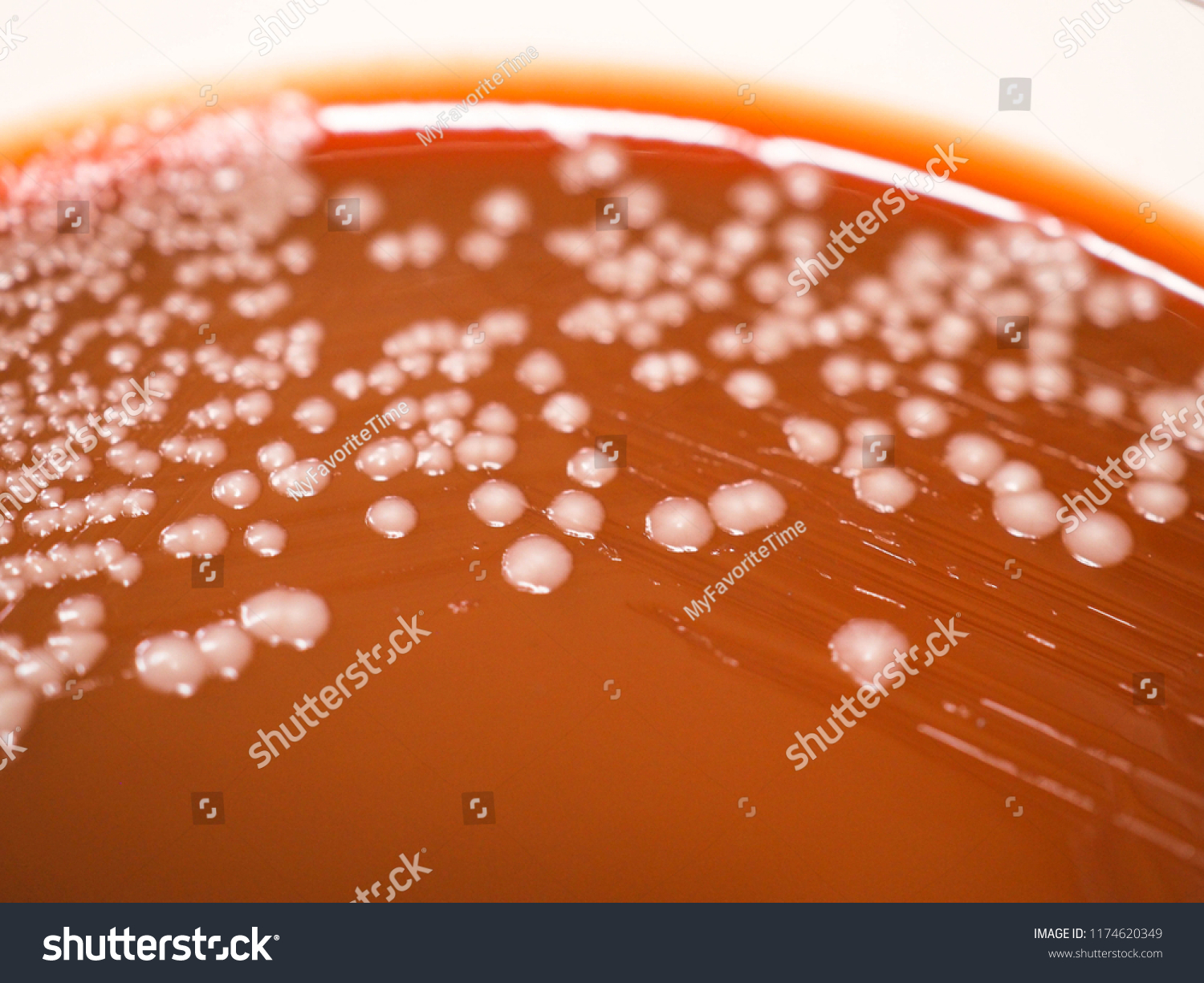 Colonies Cryptococcus Neoformans On Chocolate Agar Stock Photo (Edit ...