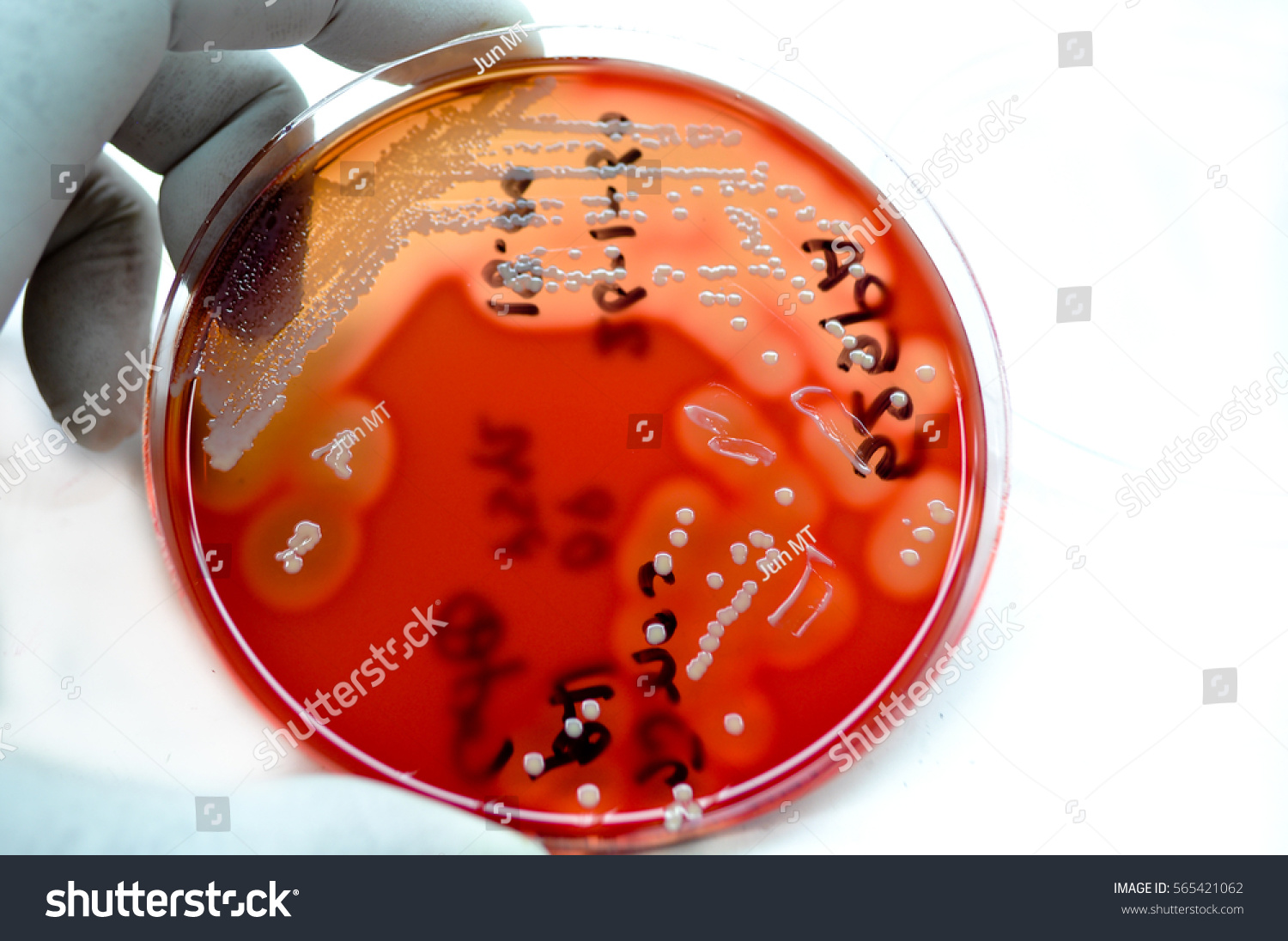 Colonies White Bacteria Beta Hemolysis Culture Stock Photo Edit Now