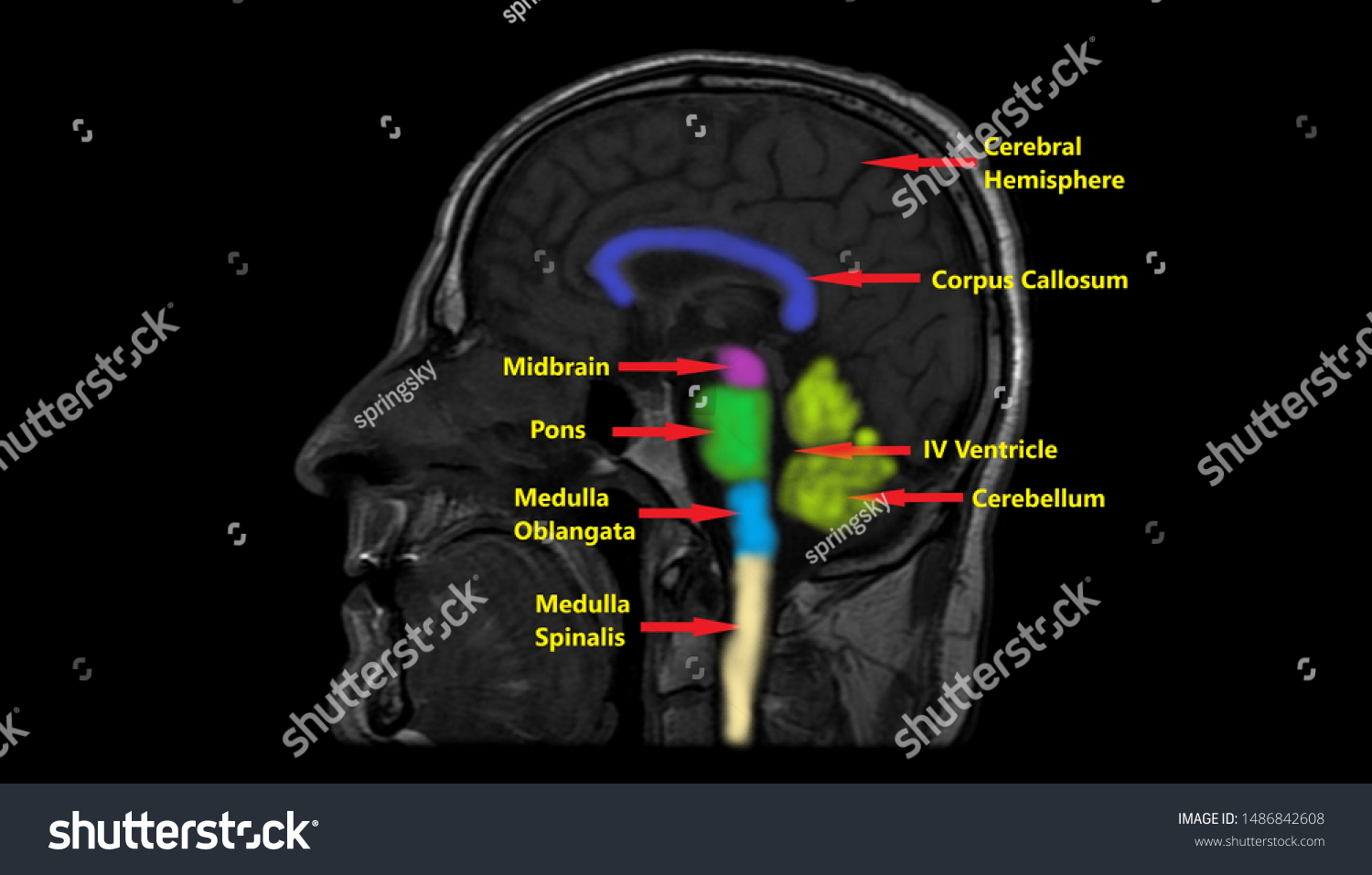 Colored Annotated Mri Anatomy Brain Saggital