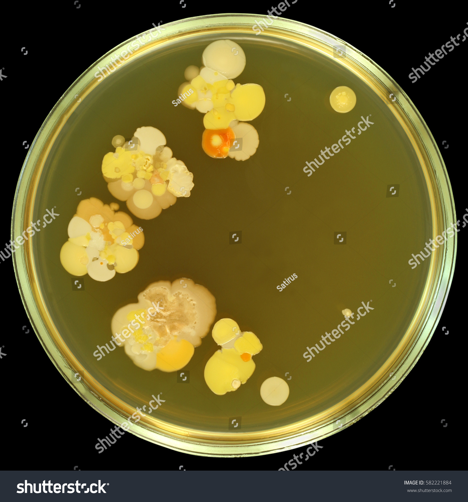 Colorful Bacterial Colonies Like Flowers Human Stock Photo 582221884 ...