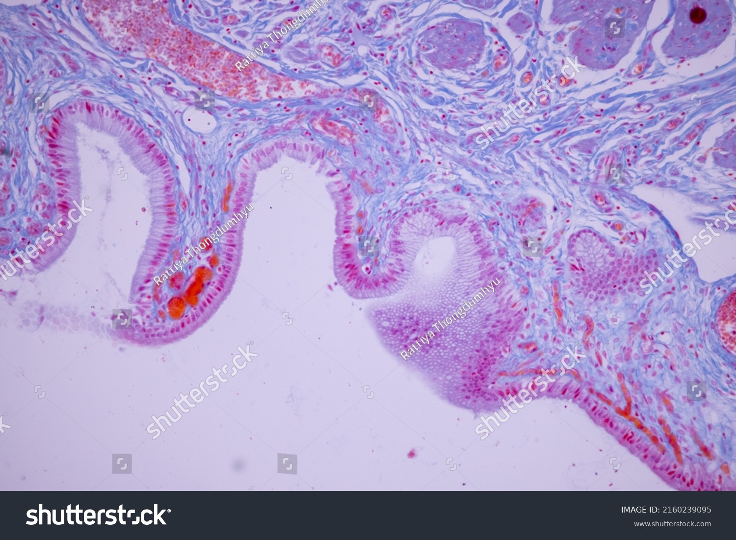 Columnar Epithelium Human Gall Bladder Under Stock Photo 2160239095 ...