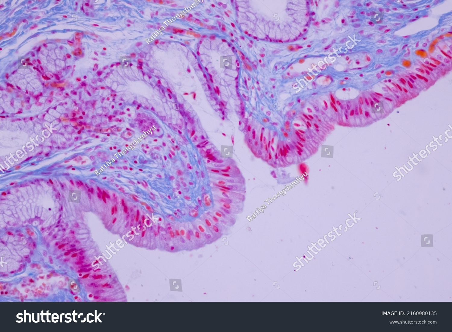 Columnar Epithelium Human Gall Bladder Under Stock Photo 2160980135 ...