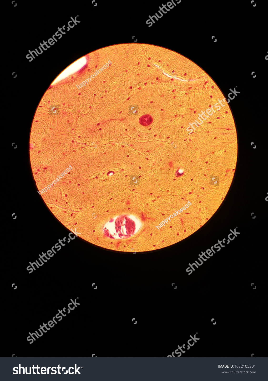 Compact Bone Structure Under Microscope Stock Photo 1632105301 Compact Bone Structure Under Microscope Stock Photo 1632105301