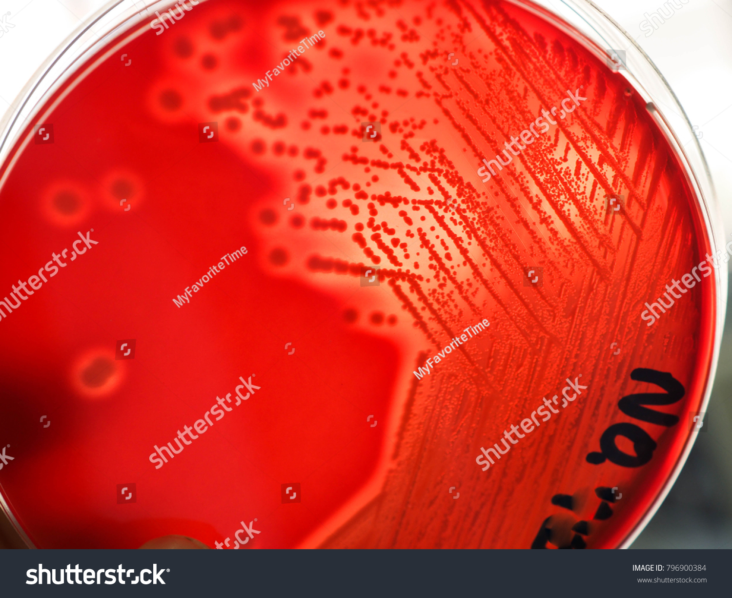 Beta-hemolysis Images, Stock Photos & Vectors | Shutterstock