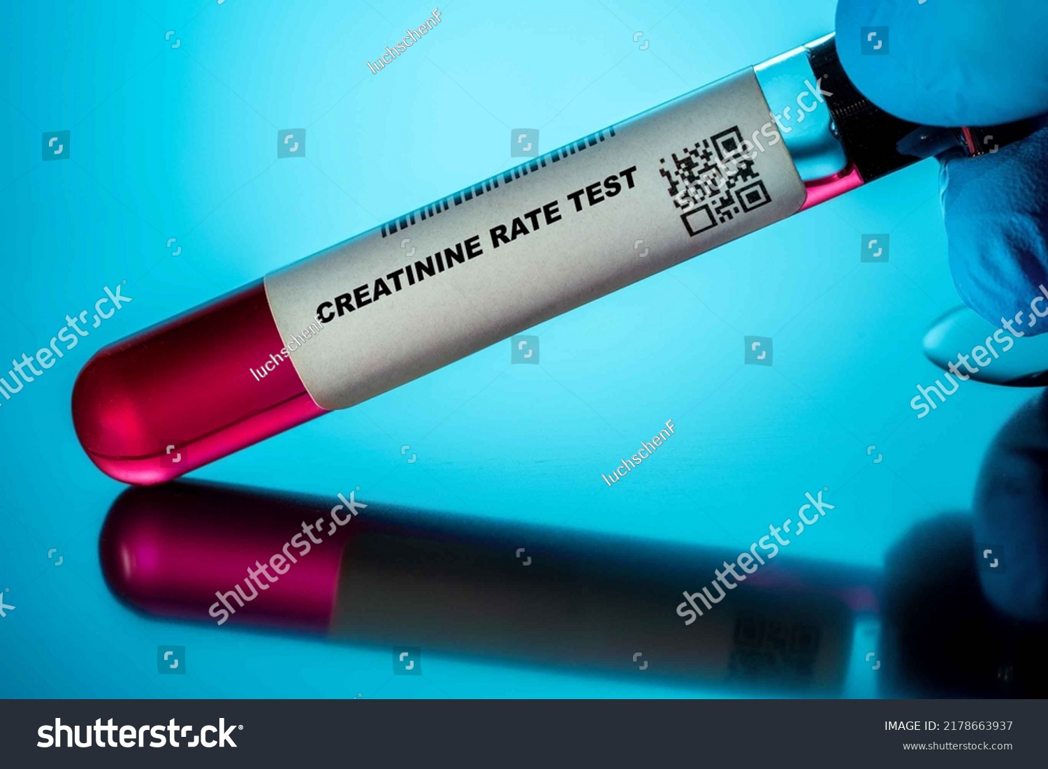 creatinine-rate-test-blood-tests-older-stock-photo-2178663937