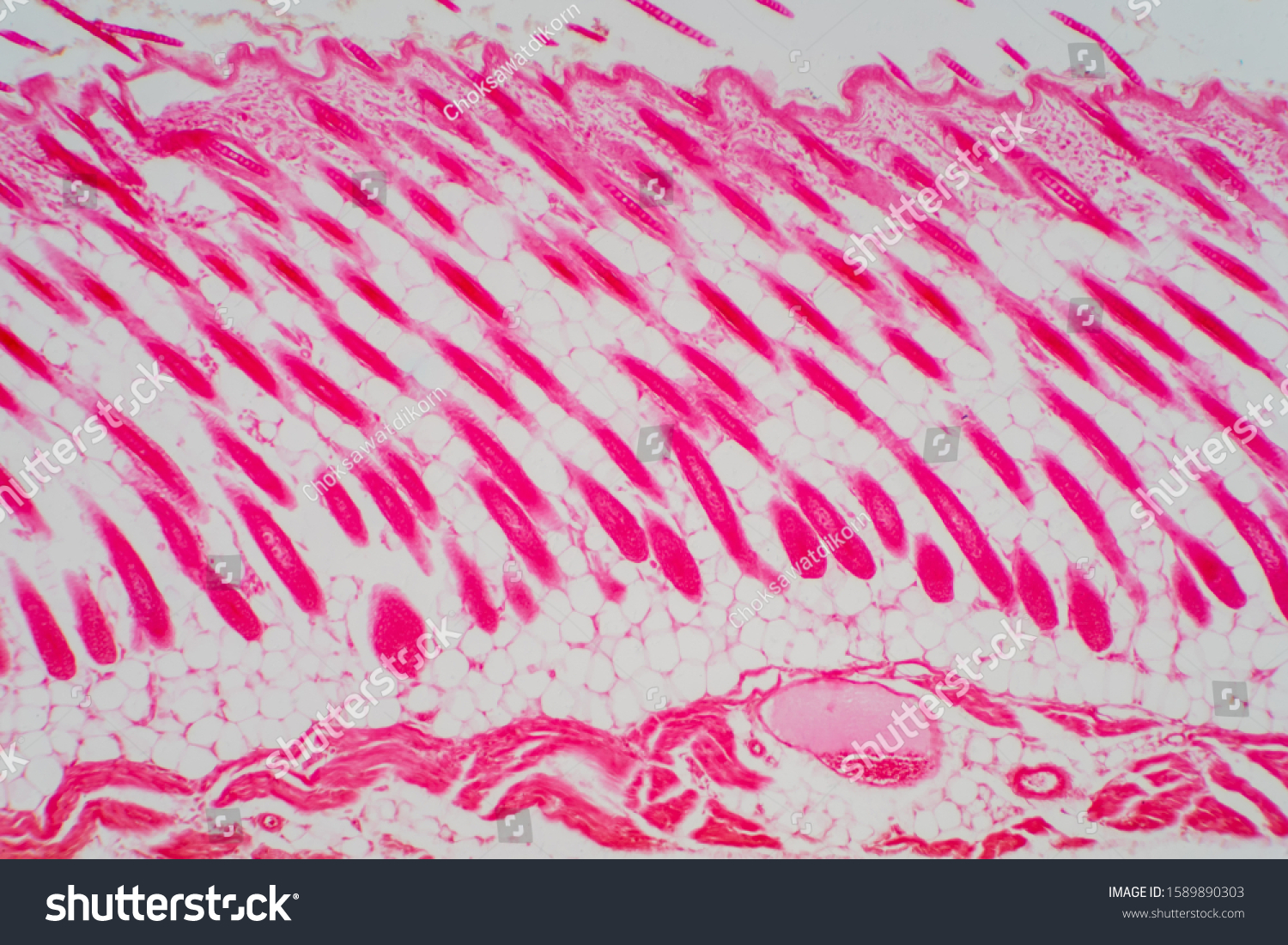 Cross Section Human Skin Head Under Stock Photo (Edit Now) 1589890303