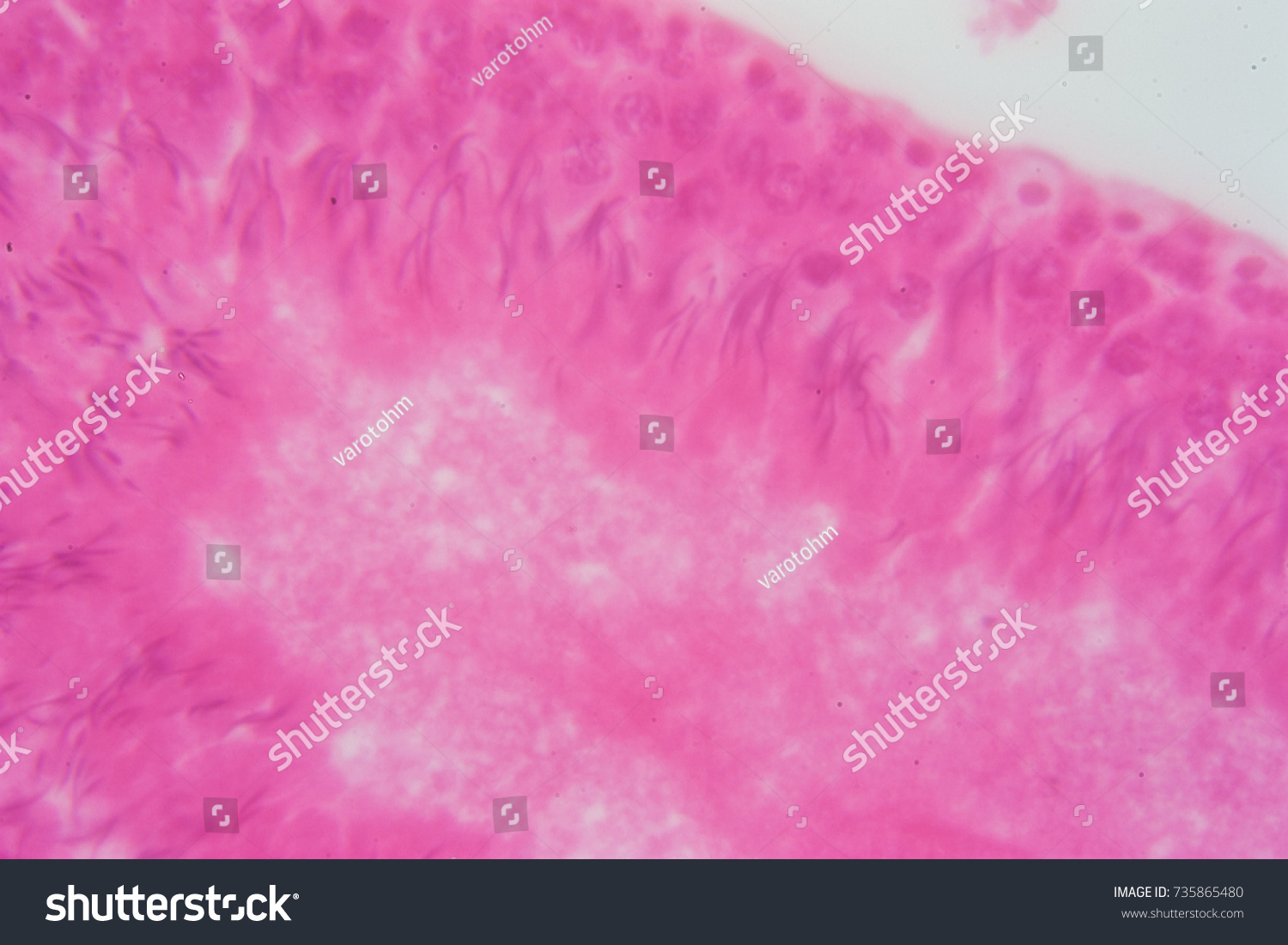 Cross Section Human Testis Under Microscope Stock Photo Edit Now