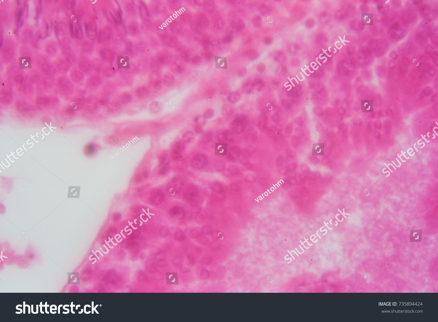 Cross Section Human Testis Under Microscope Foto De Stock Editar Ahora