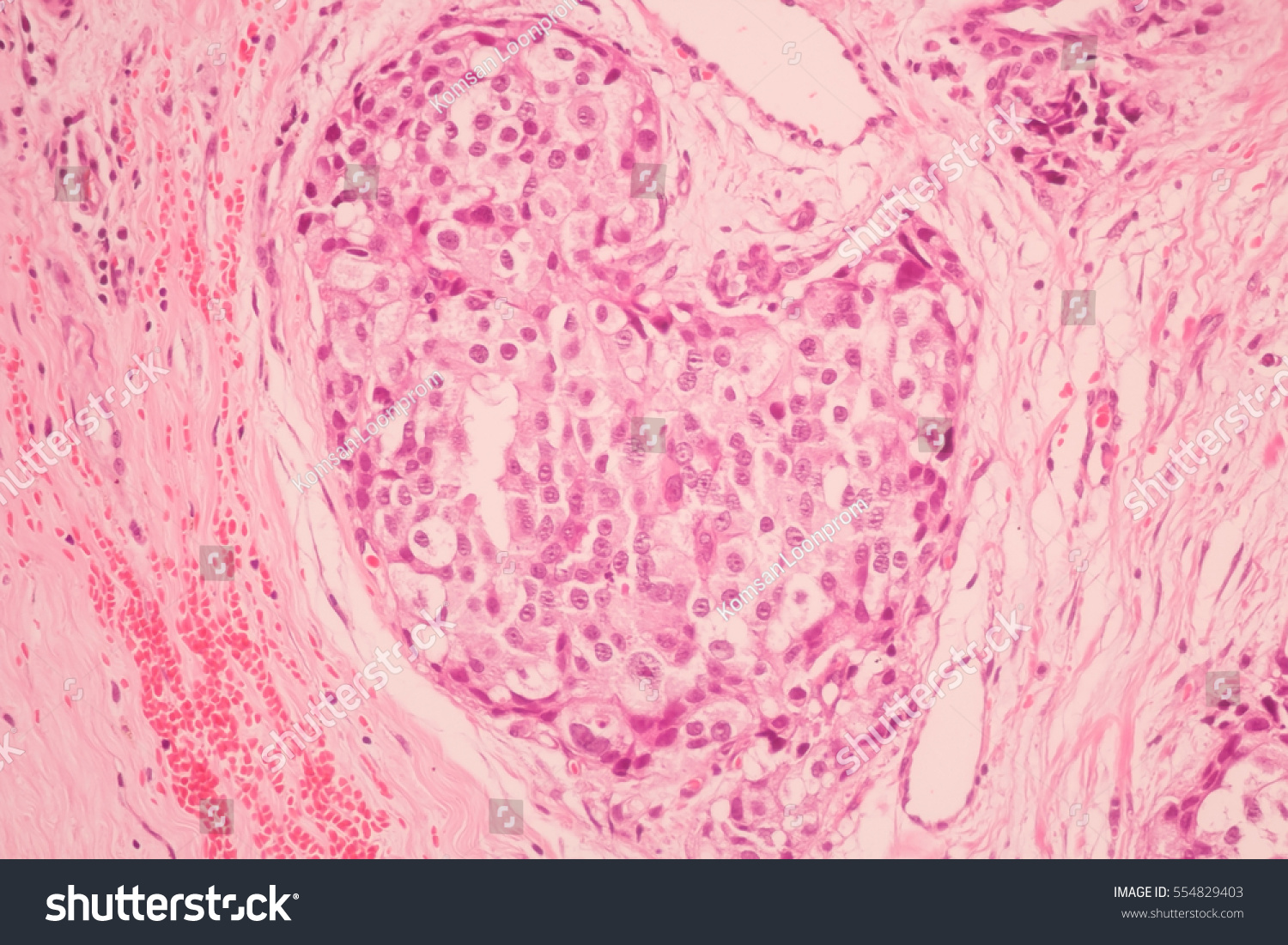 Cross Section Human Tissue Microscope Viewmedical Stock Photo 554829403 ...