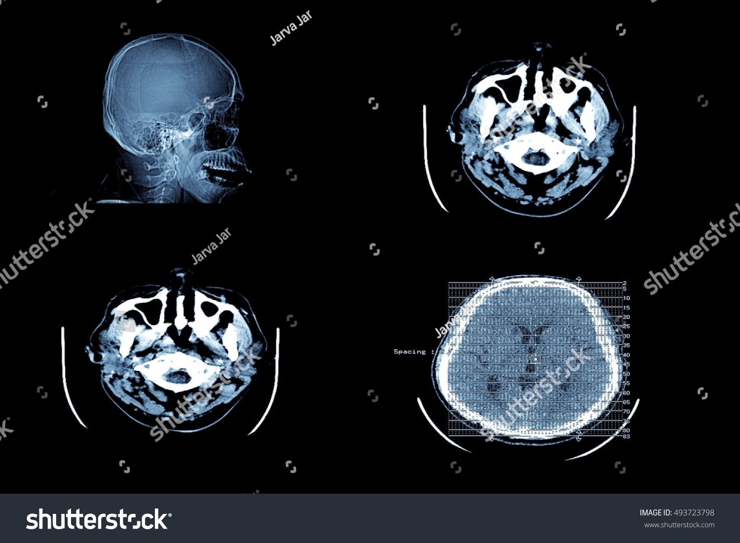 ct scan of brain reveals in hindi