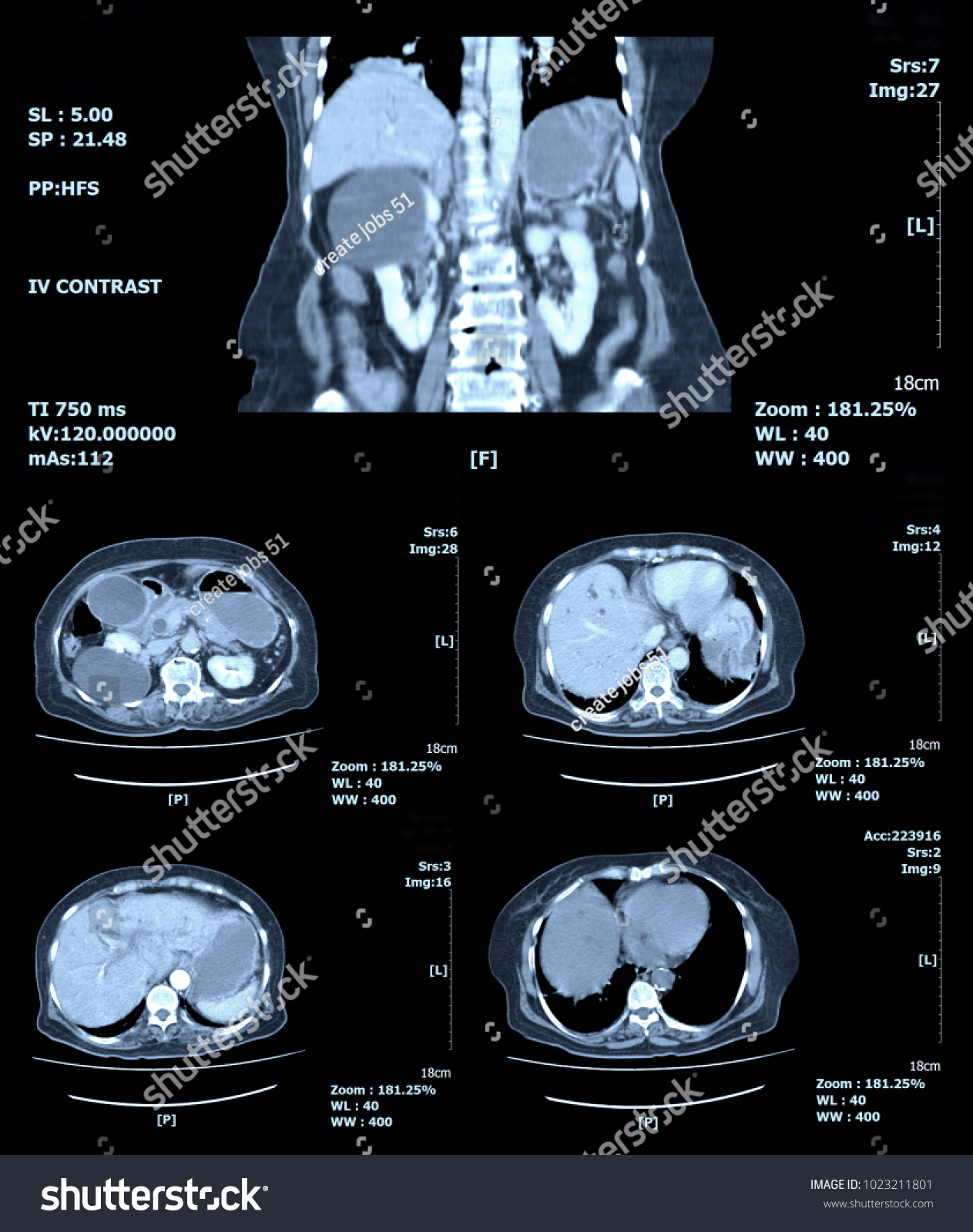 Ct Scan Abdomen By Mri Scan の写真素材 今すぐ編集