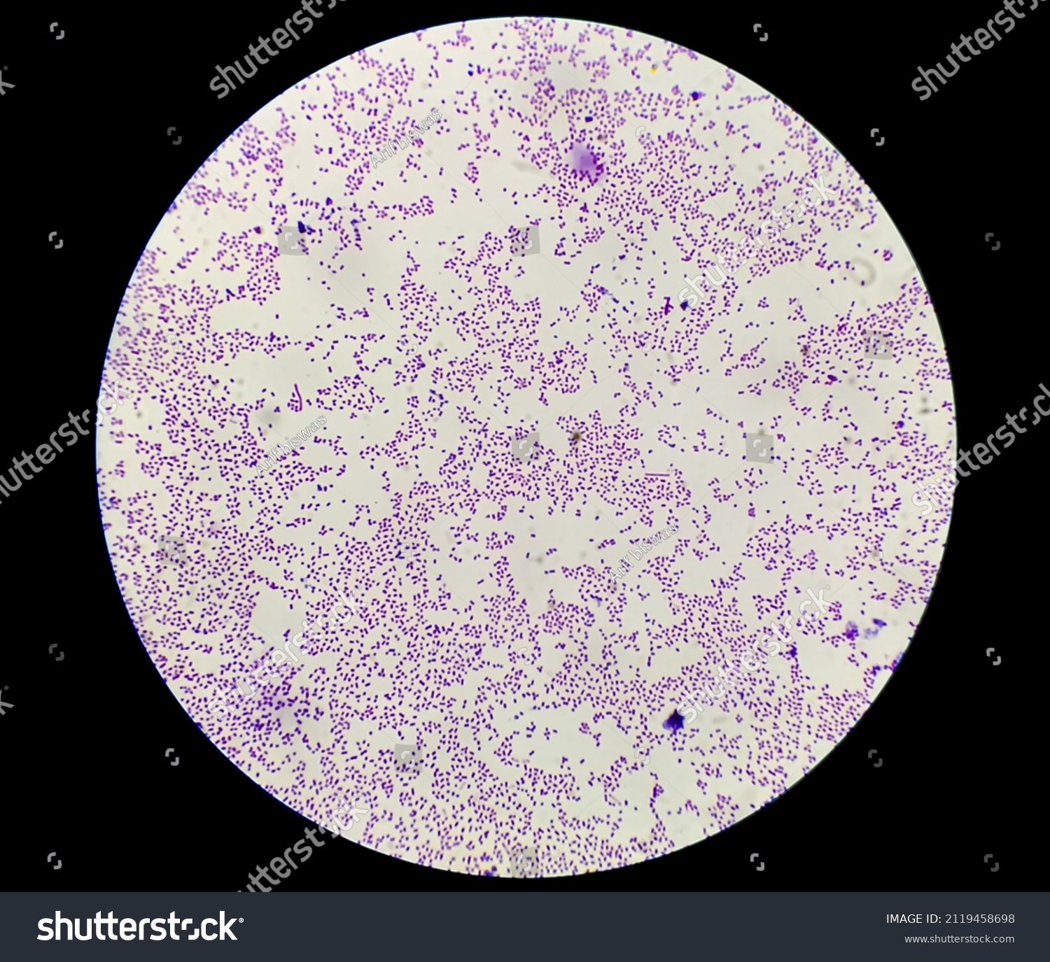 Culture Colonies Gram Stain Microscopic Shoe Stock Photo