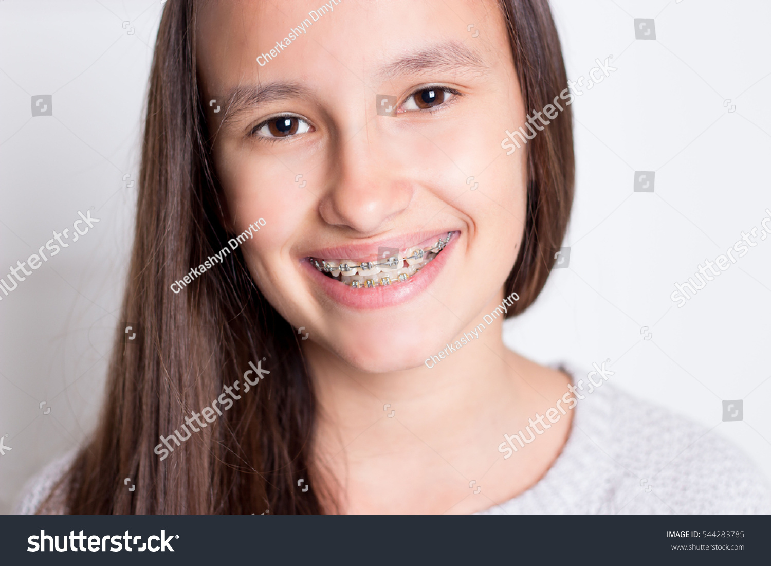 Cute Girl Braces For Teeth