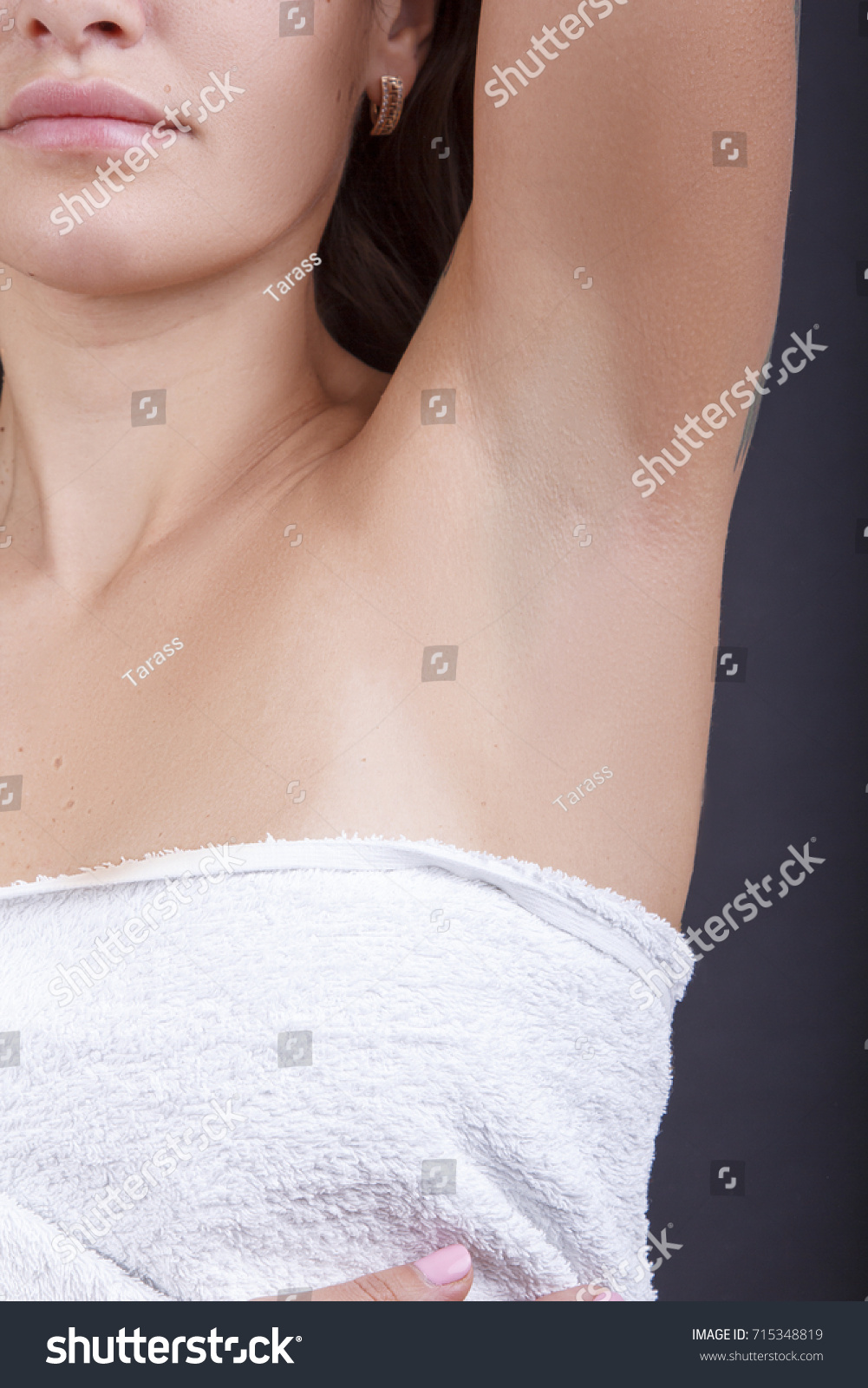 Demonstrating Results Laser Hair Removal Underarm Stock Photo