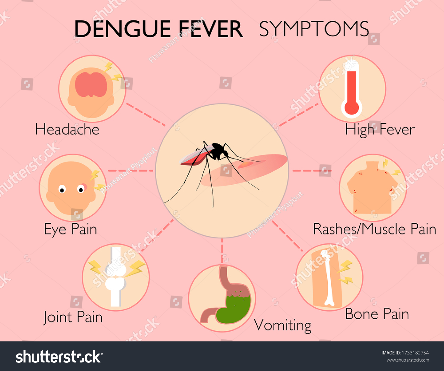 Dengue Fever Symptoms Infographic Mosquito Cause ภาพประกอบสต็อก 1733182754