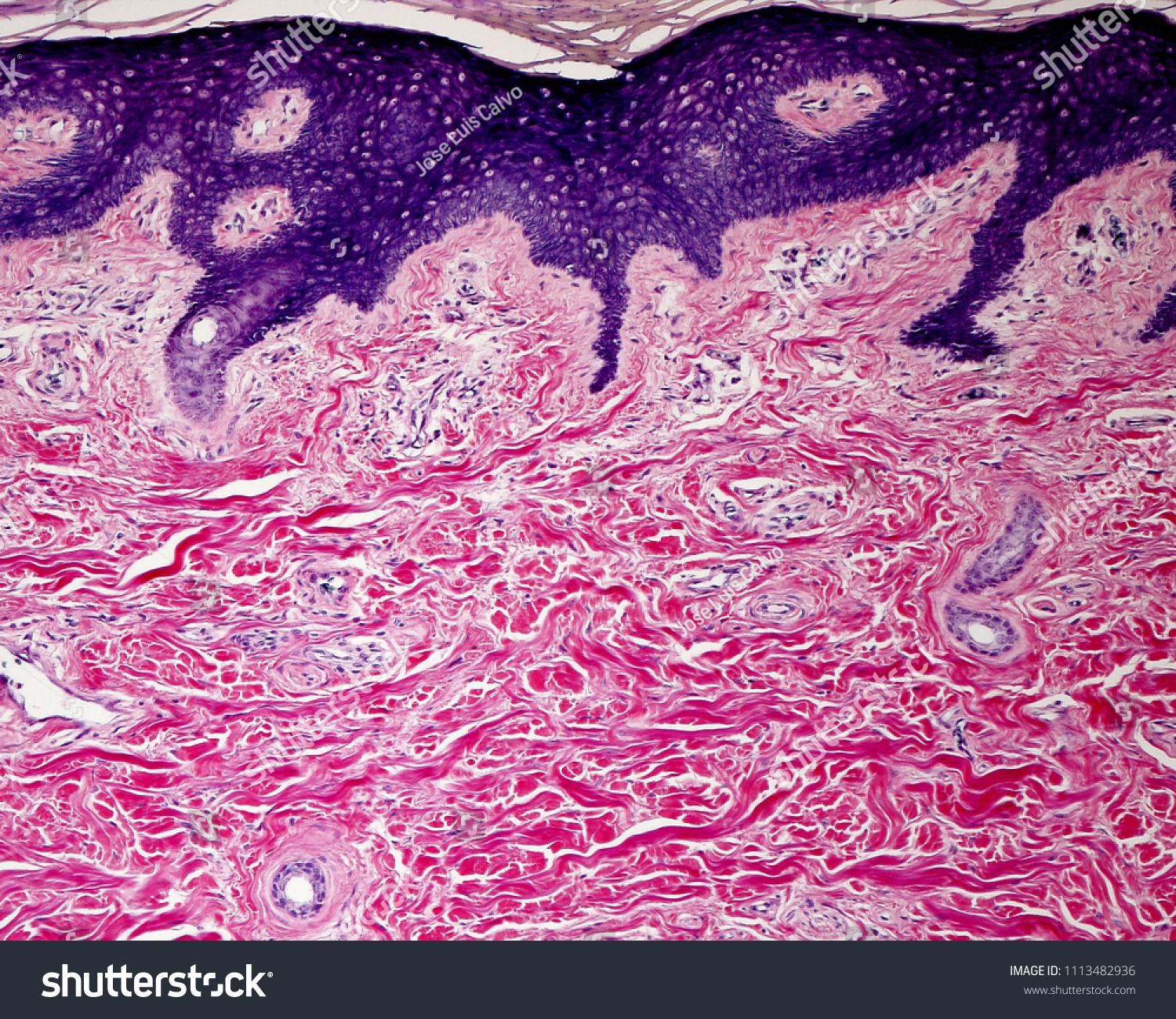 Dense Irregular Connective Tissue Reticular Dermis Stock Photo Edit Now 1113482936