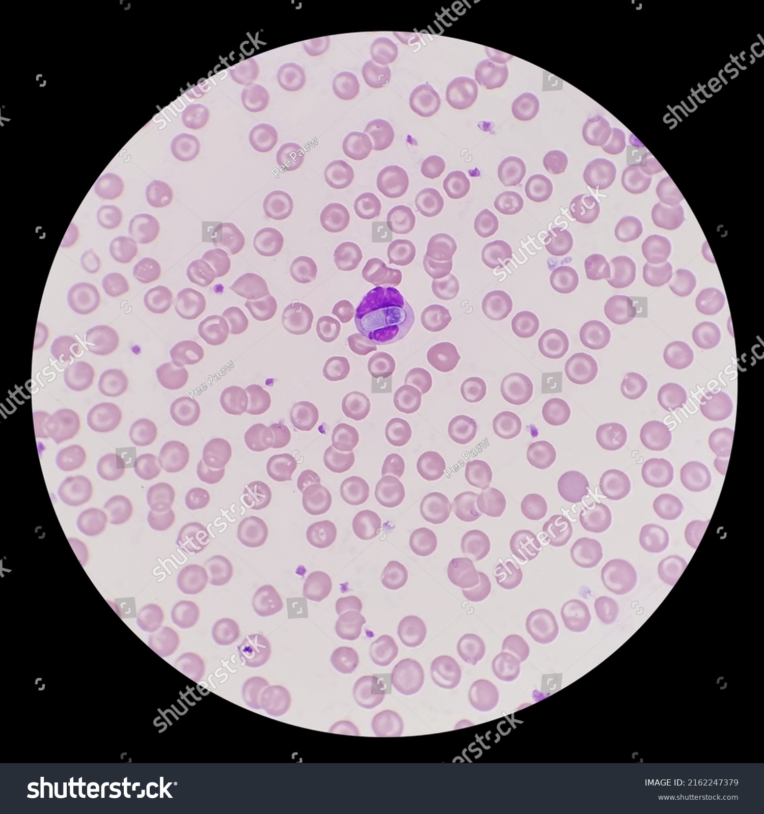 Detection Intracellular Hepatozoon Canis Gamonts Neutrophils Stock ...