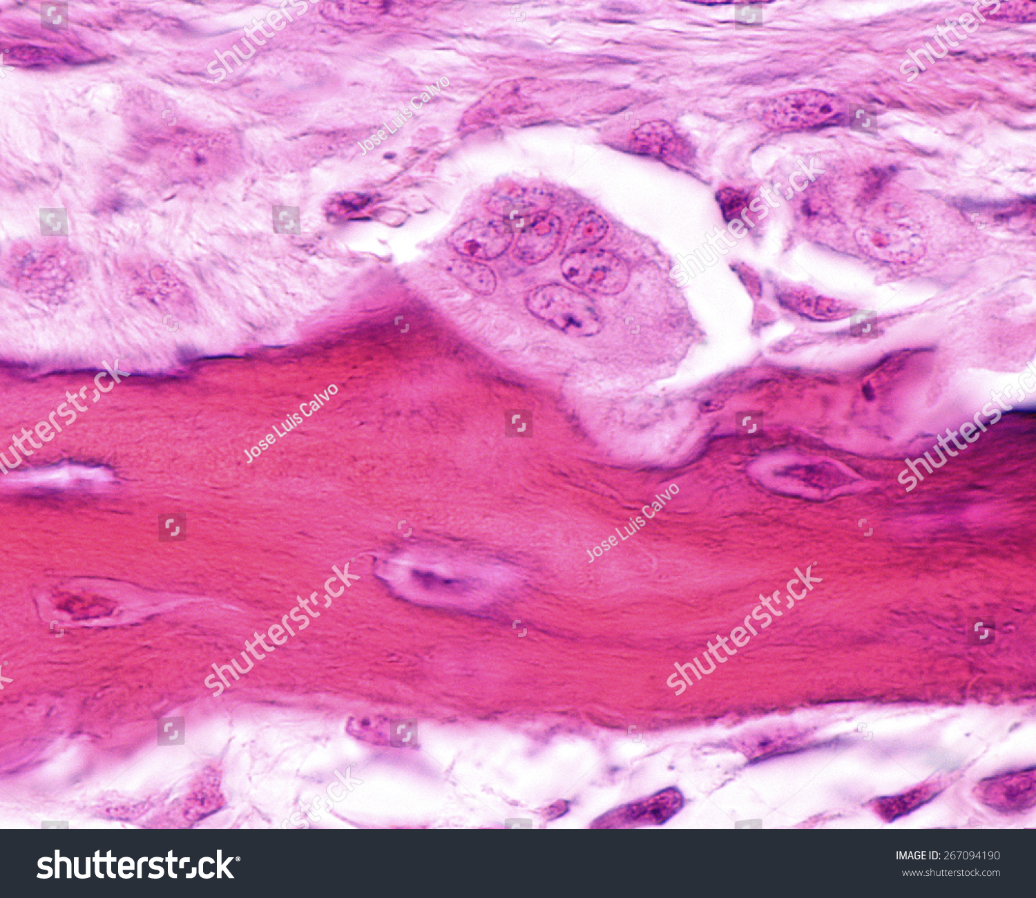 Developing Bone Showing An Osteoclast Located In Its Howships Lacuna ...