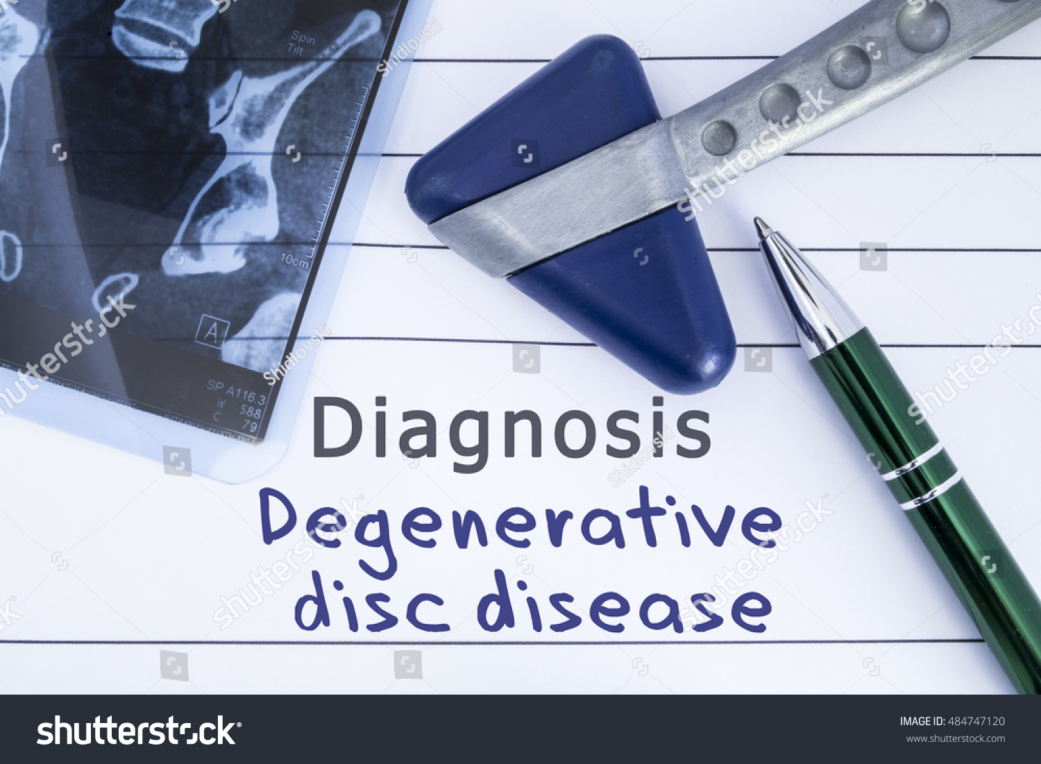 Diagnosis Degenerative Disc Disease Medical Health Stock Photo (Edit ...