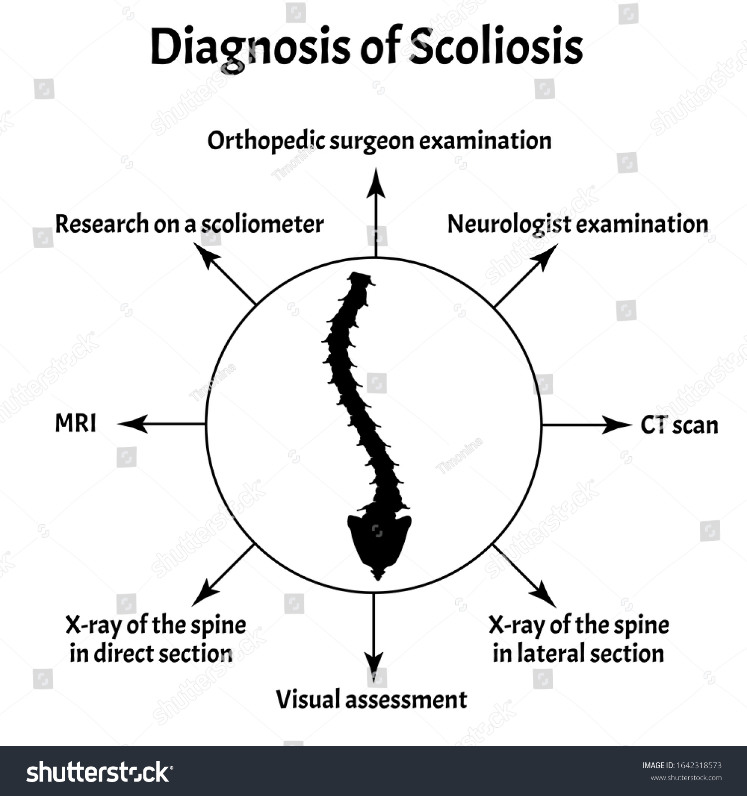 Diagnosis Scoliosis Spinal Curvature Kyphosis Lordosis Stock ...