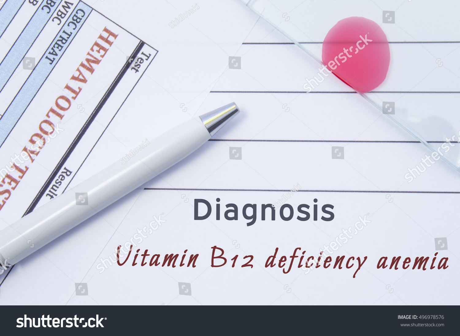 Diagnosis Vitamin B12 Deficiency Anemia Written Foto De Stock 496978576 ...