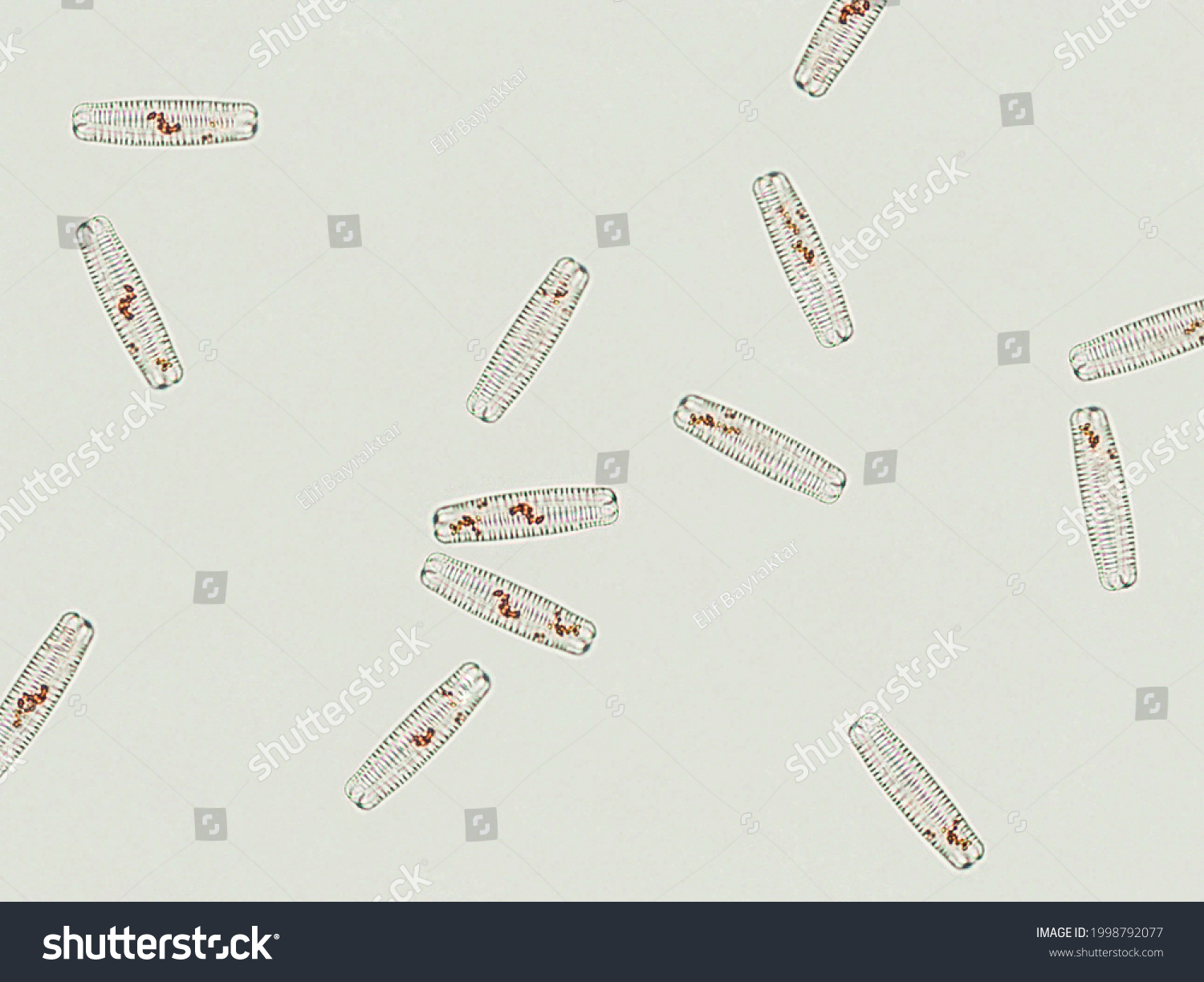 Diatom Algae Under Microscopic View Stock Photo 1998792077 | Shutterstock