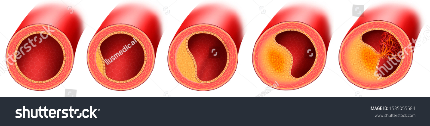 thick-blood-images-stock-photos-vectors-shutterstock