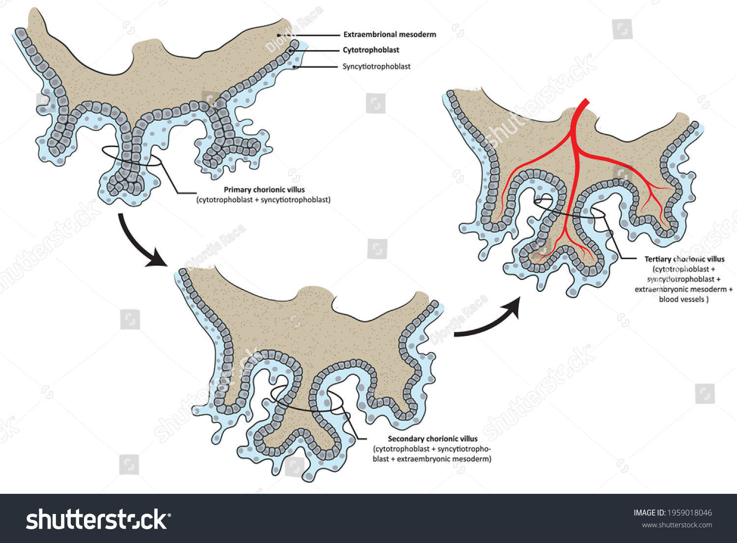 differentiation-chorionic-villus-primary-secondary-tertiary