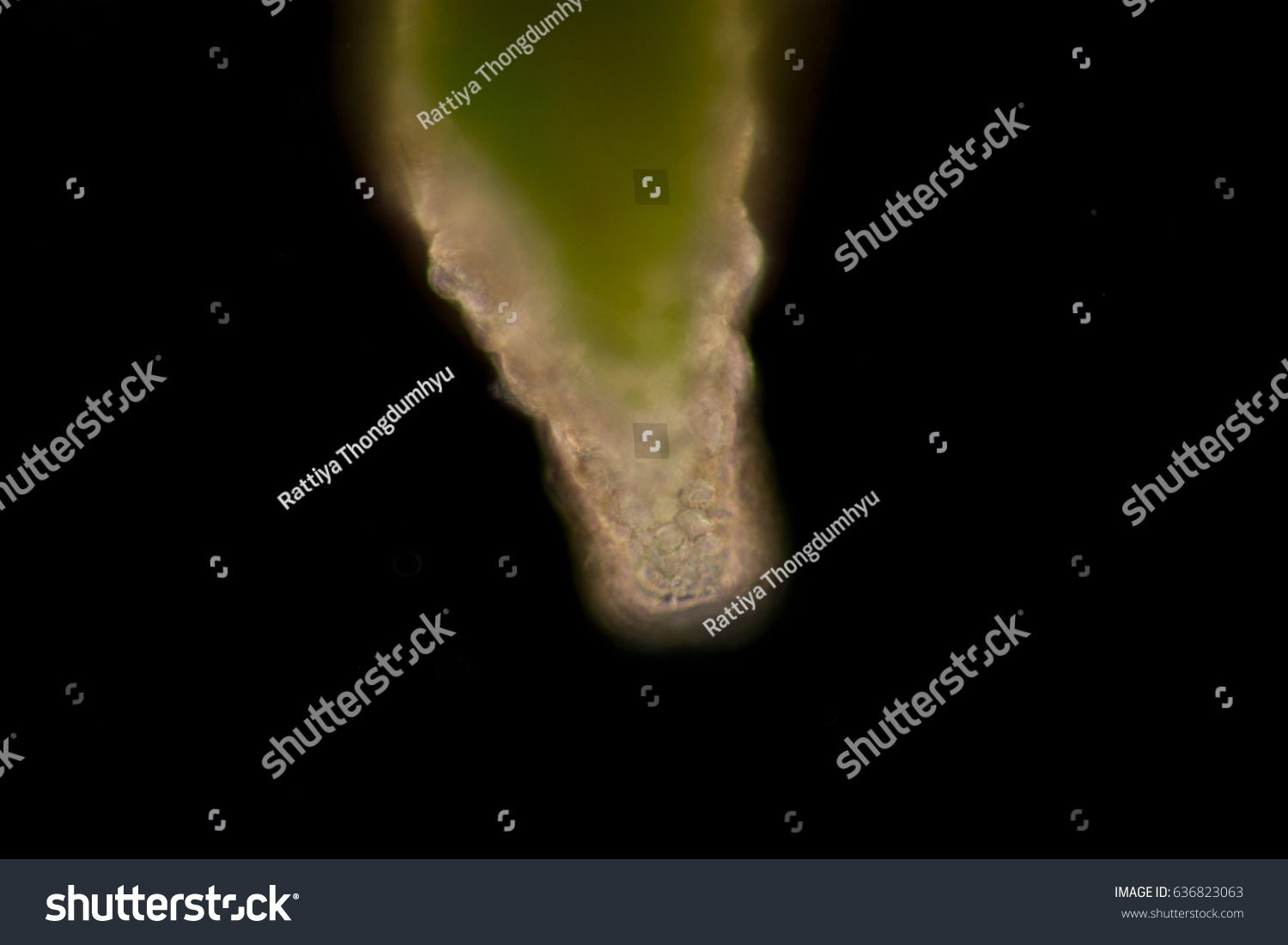 Difflugia Spprotozoa Under Microscope Stock Photo 636823063 