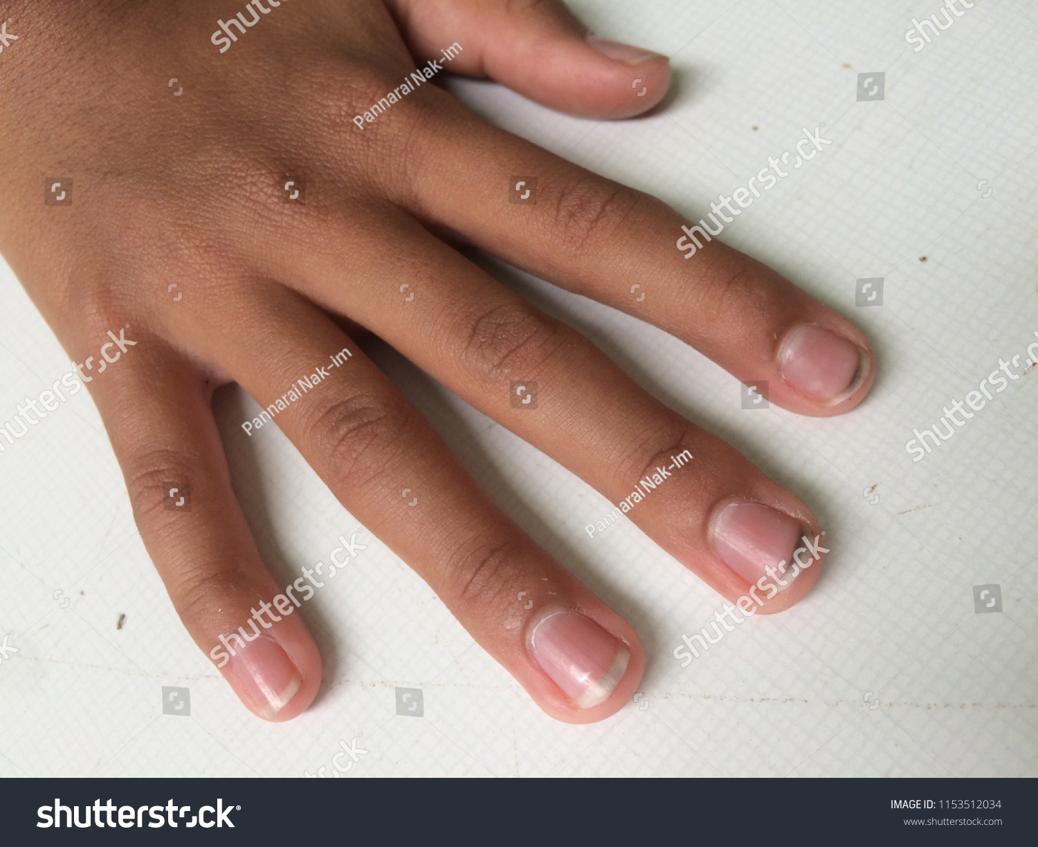 Dirty Long Nails Have Germs Make Stock Photo Edit Now