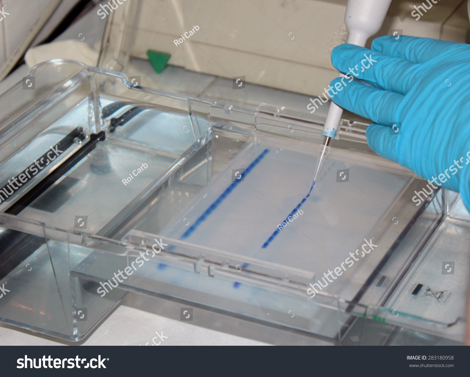 Dna Test Father Paternity In Agarose Gel. Stock Photo 283180958 ...