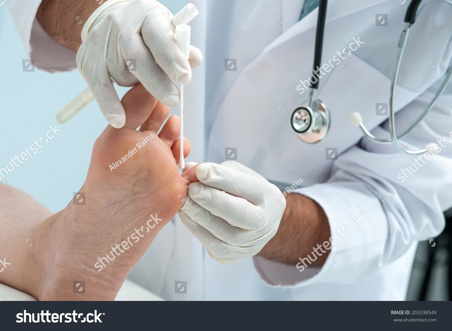 Doctor Dermatologist Examines Foot On Presence Stock Photo 203338549 ...